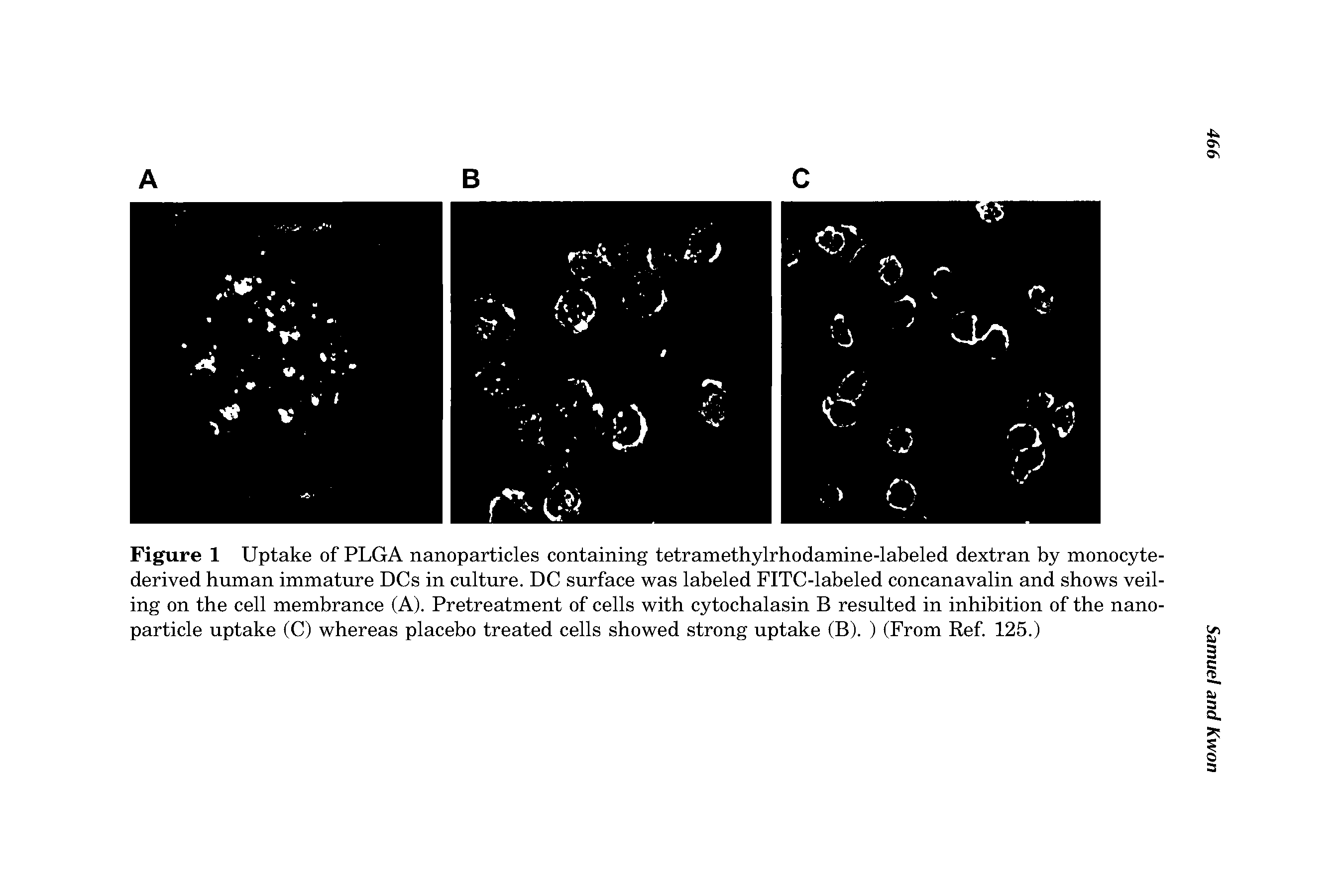 Figure 1 Uptake of PLGA nanoparticles containing tetramethylrhodamine-labeled dextran by monocyte-derived human immature DCs in culture. DC surface was labeled FITC-labeled concanavalin and shows veiling on the cell membrance (A). Pretreatment of cells with cytochalasin B resulted in inhibition of the nanoparticle uptake (C) whereas placebo treated cells showed strong uptake (B). ) (From Ref 125.)...