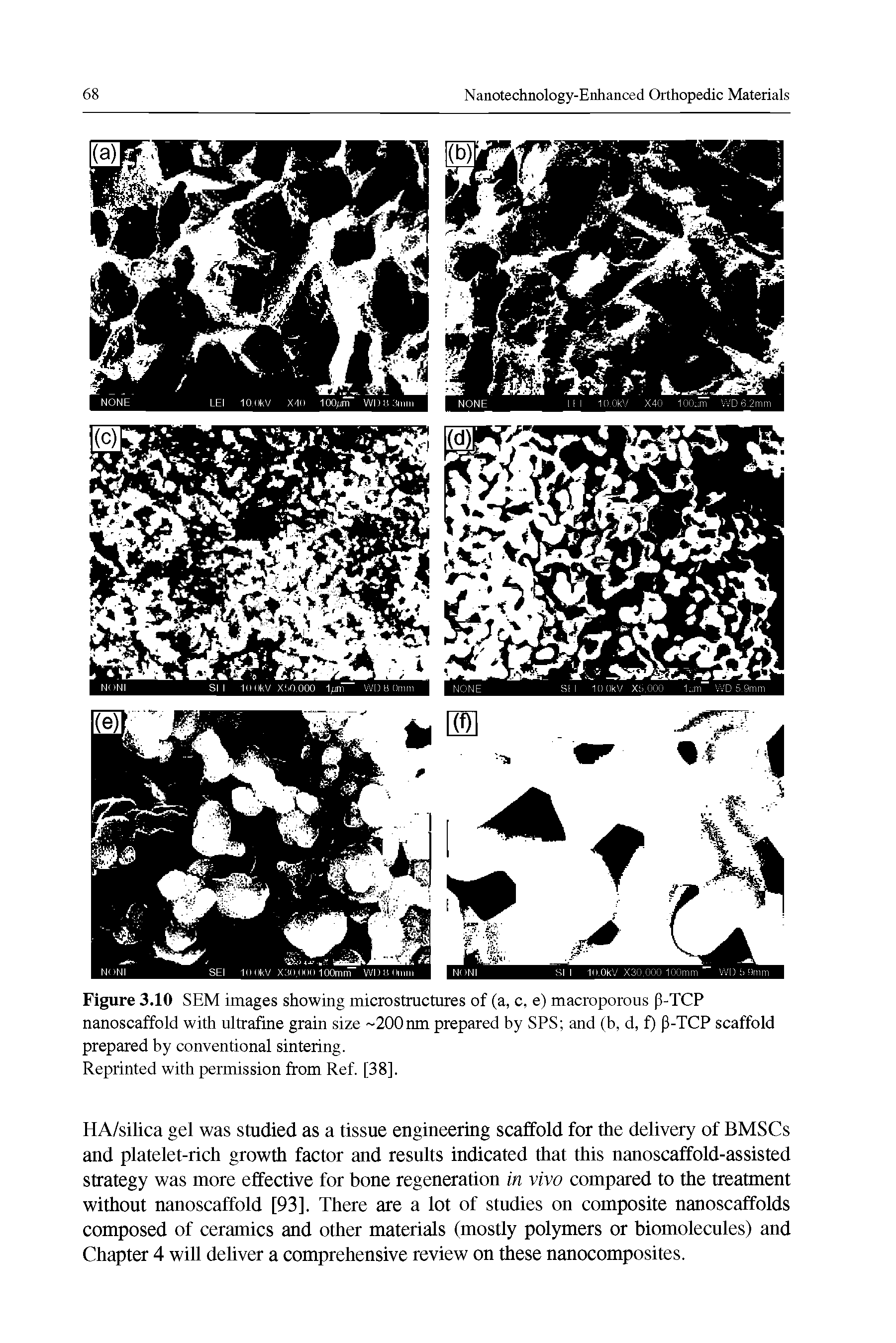 Figure 3.10 SEM images showing microstructures of (a, c, e) macroporous p-TCP nanoscaffold with ultrafine grain size 200nm prepared by SPS and (b, d, f) P-TCP scaffold prepared by conventional sintering.