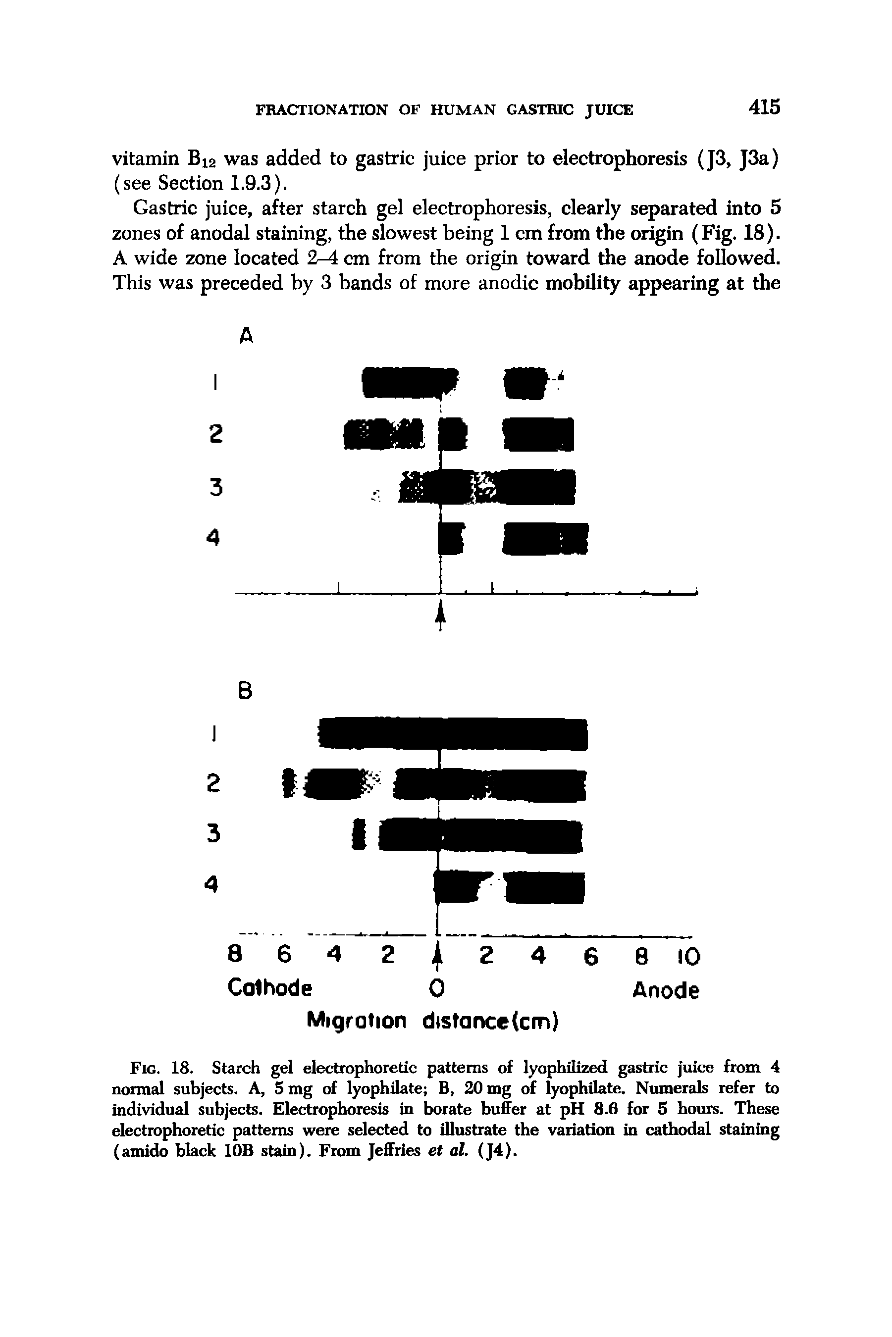 Fig. 18. Starch gel electrophoretic patterns of lyophilized gastric juice from 4 normal subjects. A, 5 mg of lyophilate B, 20 mg of lyophilate. Numerals refer to individual subjects. Electrophoresis in borate buffer at pH 8.6 for 5 hours. These electrophoretic patterns were selected to illustrate the variation in cathodal staining (amido black lOB stain). From Jeffries et al. (J4).