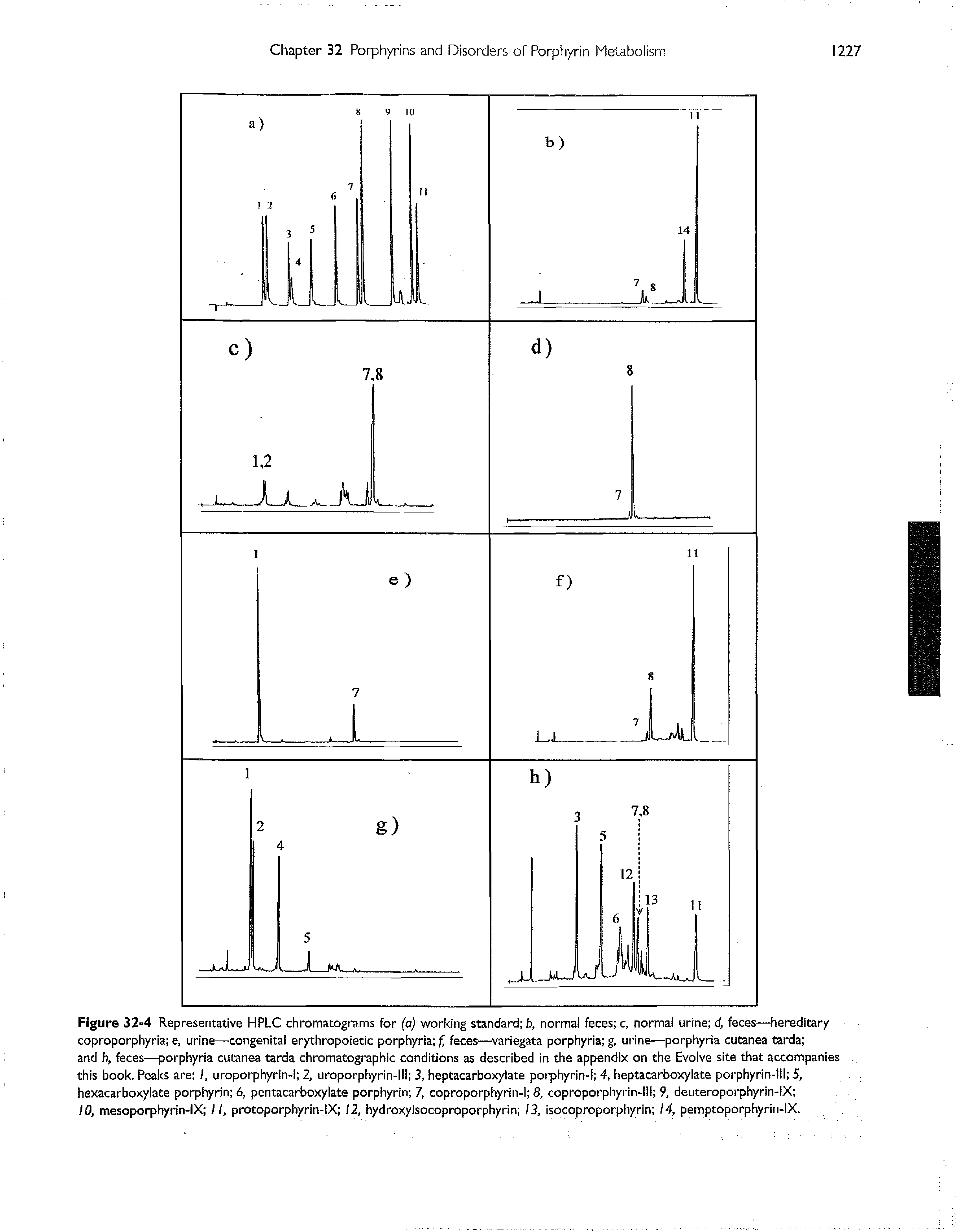 Figure 32-4 Representative HPLC chromatograms for (a) working standard b, norma) feces c, normal urine d, feces—hereditary coproporphyria e, urine—congenita erythropoietic porphyria f, feces—variegata porphyria g, urine—porphyria cutanea tarda and h, feces—porphyria cutanea tarda chromatographic conditions as described in the appendix on the Evolve site that accompanies this book. Peaks are I, uroporphyrin- 2, uroporphyrin-l 3, heptacarboxyiate porphyrin-l 4, heptacarboxylate porphyrin-tl 5, hexacarboxylate porphyrin 6, pentacarboxylate porphyrin 7, coproporphyrin-1 8, coproporphyrin- ll 9, deuteroporphyrin-IX ...