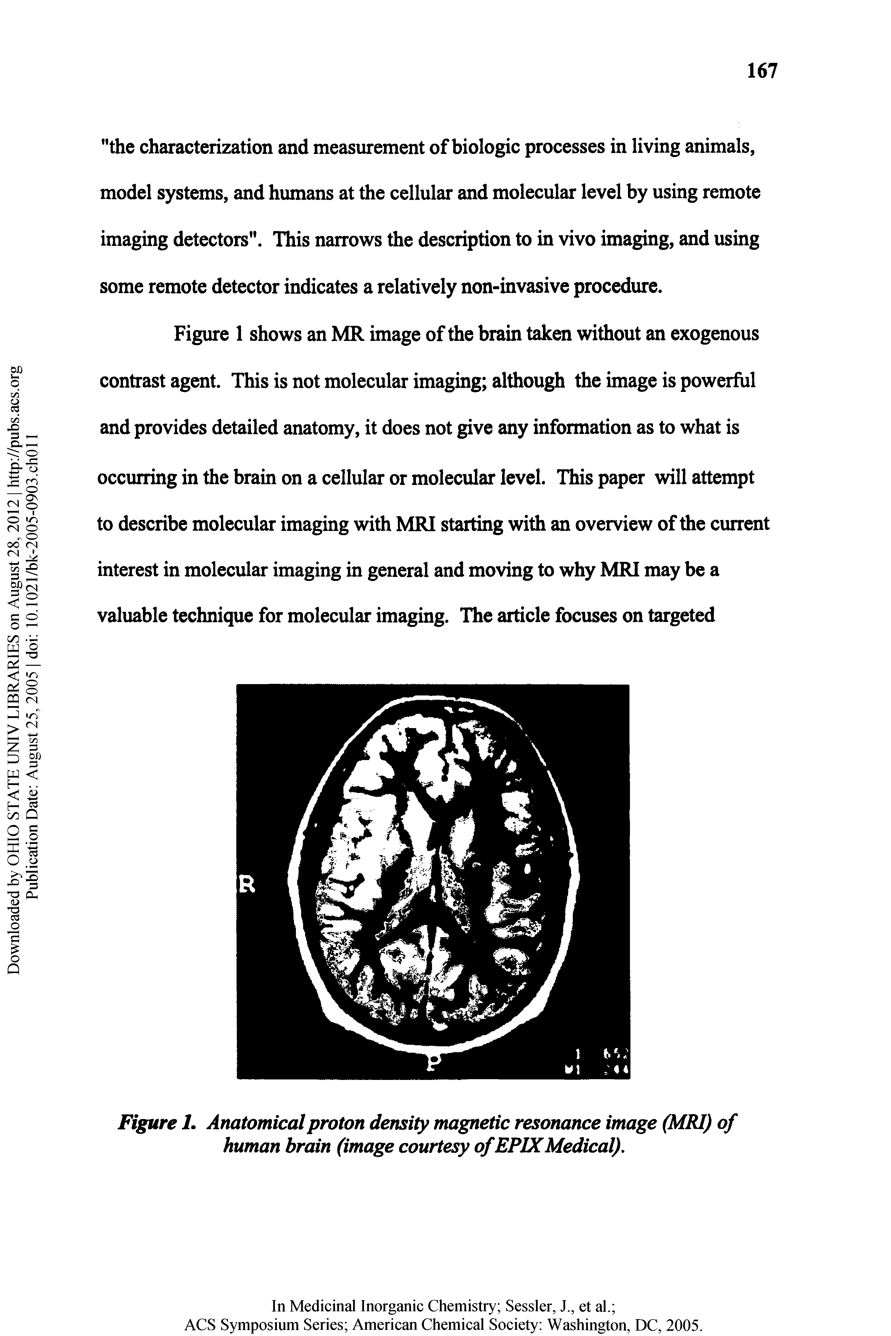 Figure I. Anatomical proton density magnetic resonance image (MRI) of human brain (image courtesy of EPIXMedical).