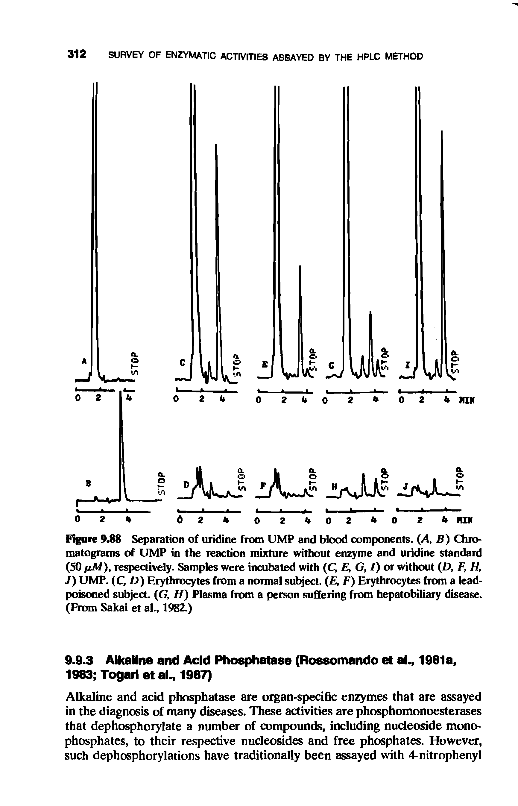 Figure 9.88 Separation of uridine from UMP and blood components. (A, B) Chromatograms of UMP in the reaction mixture without enzyme and uridine standard (50 fiM), respectively. Samples were incubated with (C, E, G, /) or without (D, F, H, J) UMP. QD) Erythrocytes from a normal subject. ( , F) Erythrocytes from a lead-poisoned subject. (G, H) Plasma from a person suffering from hepatobiliary disease. (From Sakai et al., 1982.)...