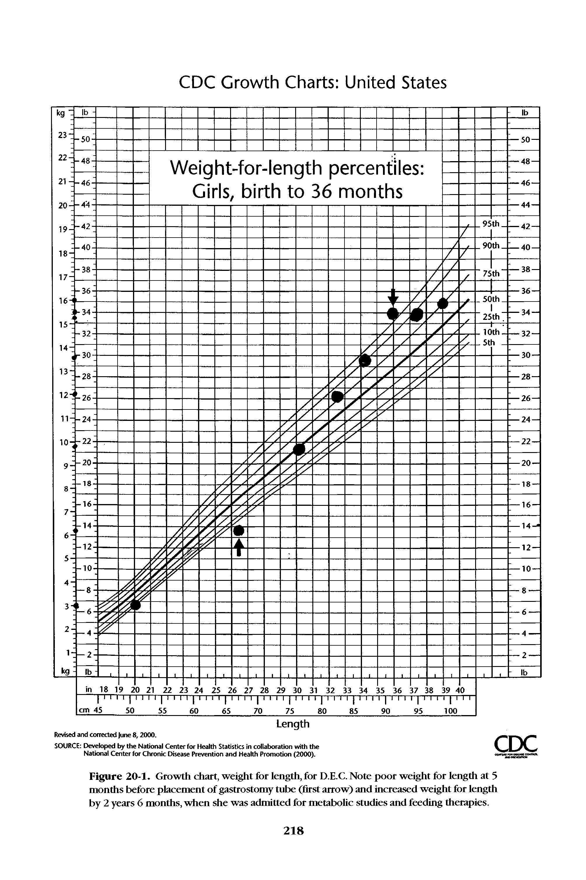 Figure 20-1. Growth chart, weight for length, for D.E.C. Note poor weight for length at 5 months before placement of gastrostomy tube (first arrow) and increased weight for length by 2 years 6 months, when she was admitted for metabolic studies and feeding therapies.