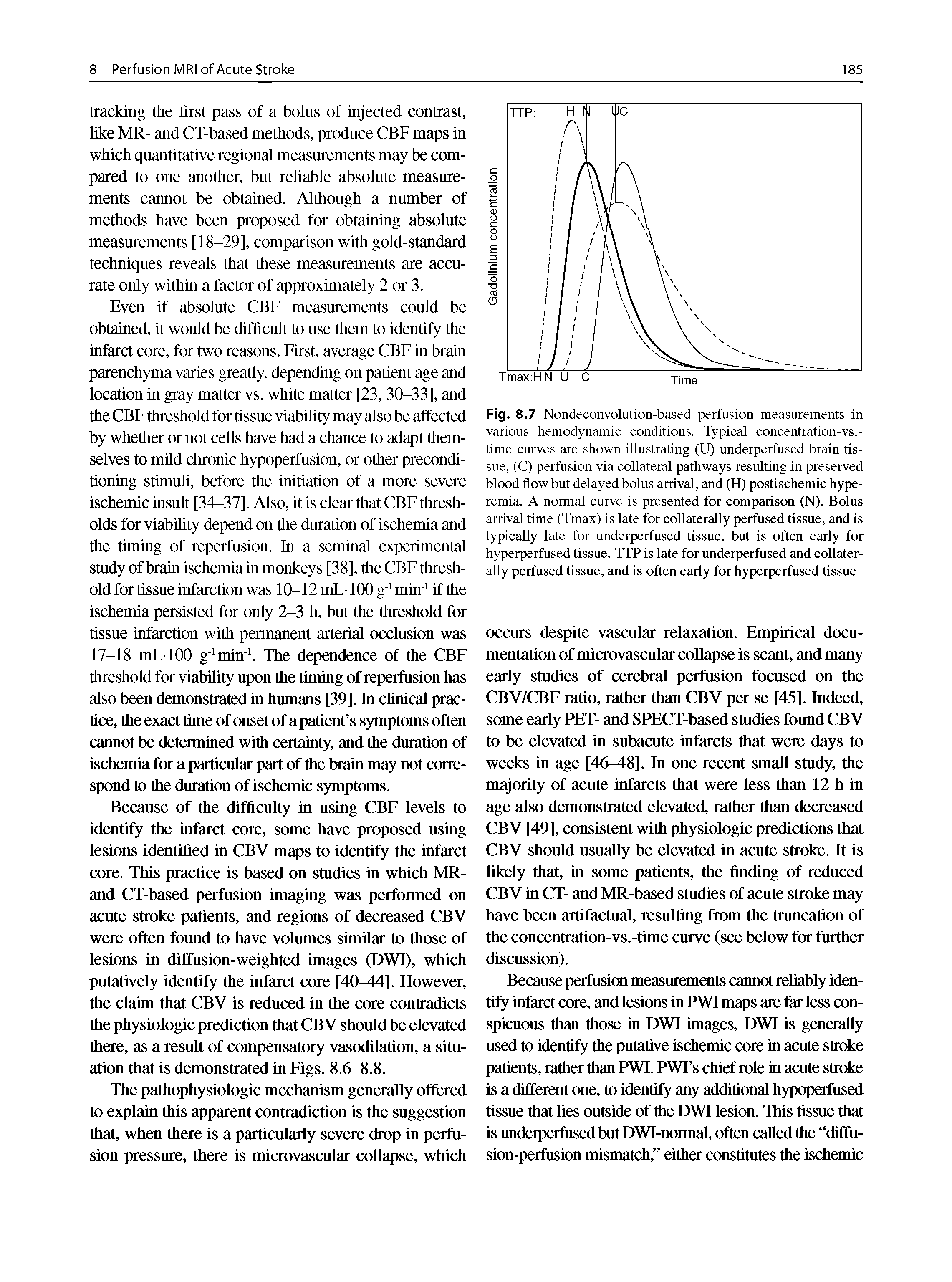 Fig. 8.7 Nondeconvolution-based perfusion measurements in various hemodynamic conditions. Typical concentration-vs.-time curves are shown illustrating (U) underperfused brain tissue, (C) perfusion via collateral pathways resulting in preserved blood flow but delayed bolus arrival, and (H) postischemic hyperemia. A normal curve is presented for comparison (N). Bolus arrival time (Tmax) is late for collaterally perfused tissue, and is typically late for underperfused tissue, but is often early for hyperperfused tissue. TTP is late for underperfused and collaterally perfused tissue, and is often early for hyperperfused tissue...
