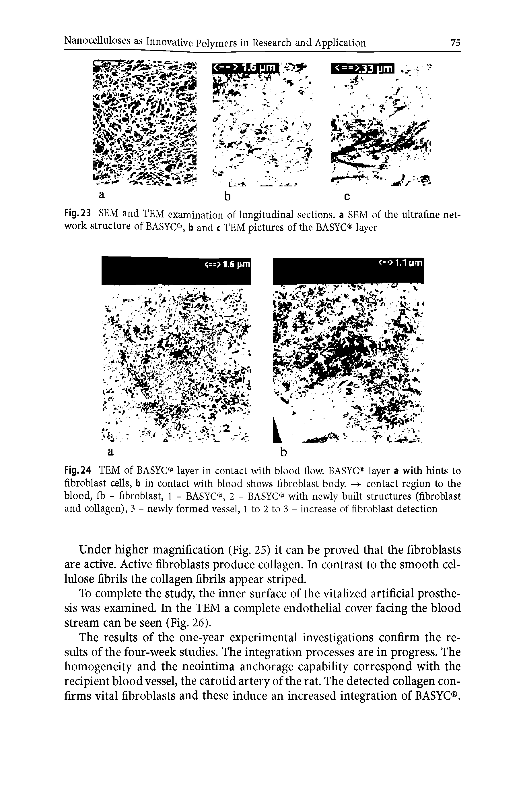 Fig. 23 SEM and TEM examination of longitudinal sections, a SEM of the ultrafine network structure of BASYC , b and c TEM pictures of the BASYC layer...