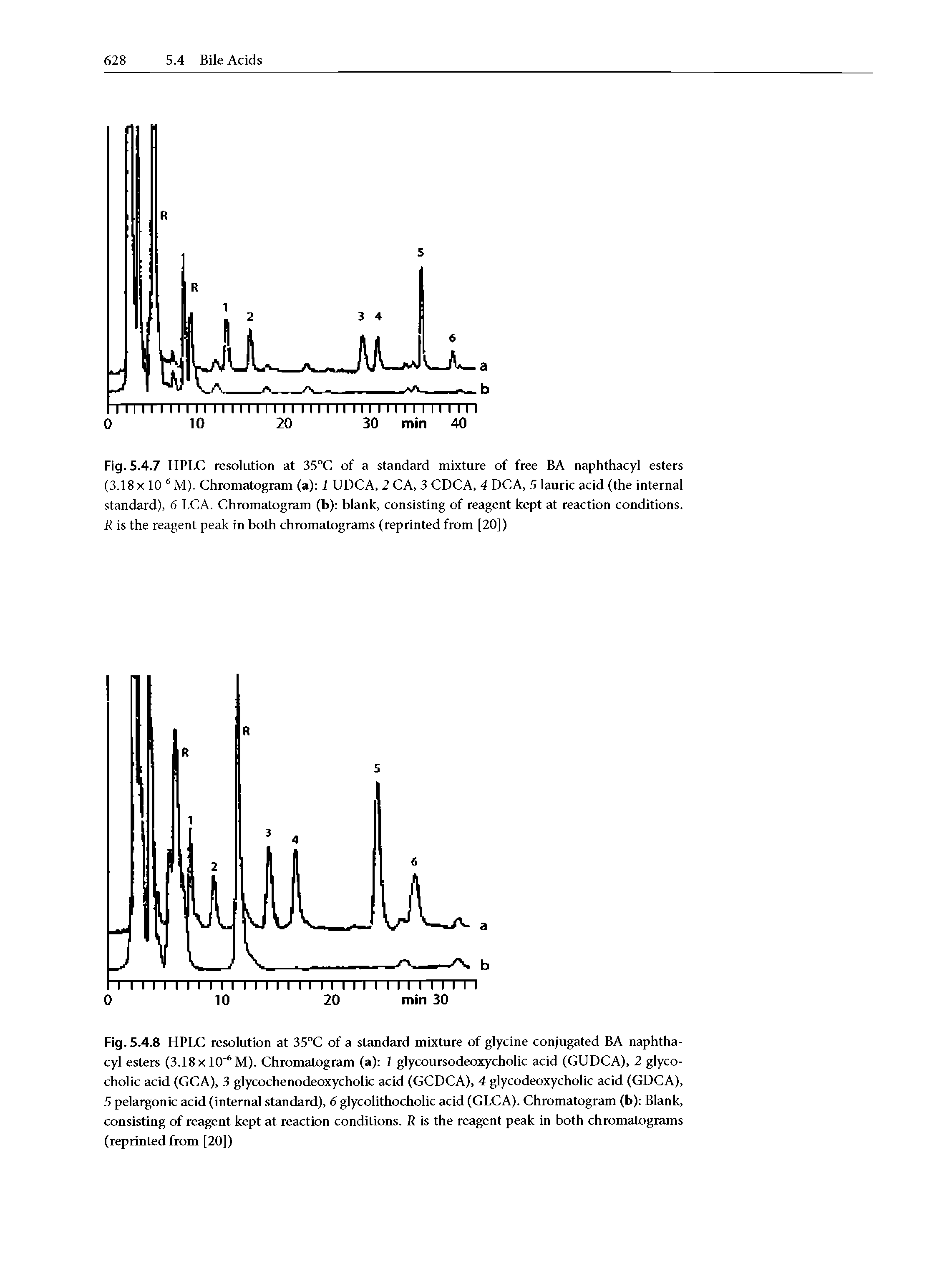 Fig. 5.4.7 HPLC resolution at 35°C of a standard mixture of free BA naphthacyl esters (3.18 x 10 6 M). Chromatogram (a) 1 UDCA, 2 CA, 3 CDCA, 4 DCA, 5 lauric acid (the internal standard), 6 LCA. Chromatogram (b) blank, consisting of reagent kept at reaction conditions. R is the reagent peak in both chromatograms (reprinted from [20])...