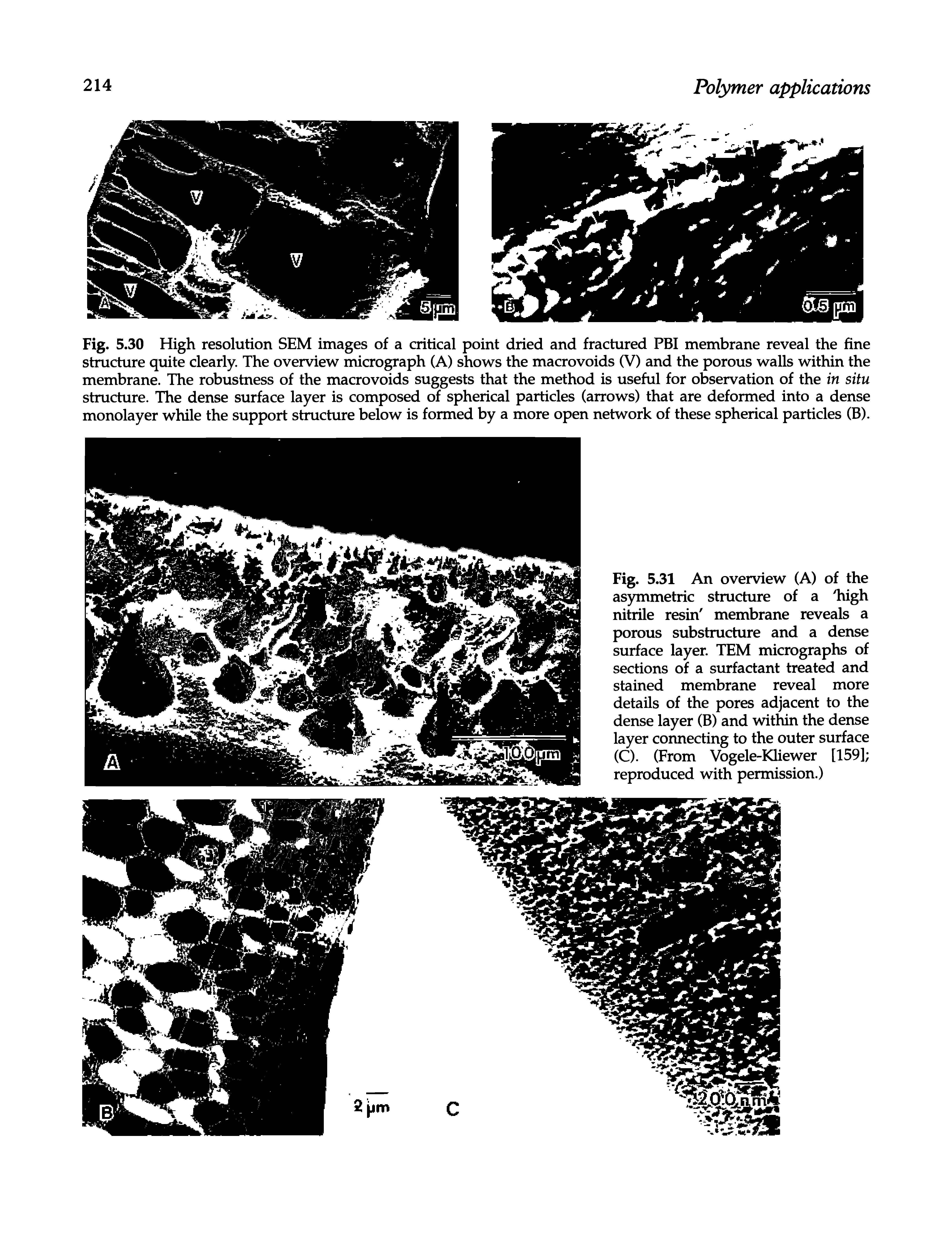 Fig. 5.30 High resolution SEM images of a critical point dried and fractured FBI membrane reveal the fine structure quite clearly. The overview micrograph (A) shows the macrovoids (V) and the porous walls within the membrane. The robustness of the macrovoids suggests that the method is useful for observation of the in situ structure. The dense surface layer is composed of spherical particles (arrows) that are deformed into a dense monolayer while the support structure below is formed by a more open network of these spherical particles (B).