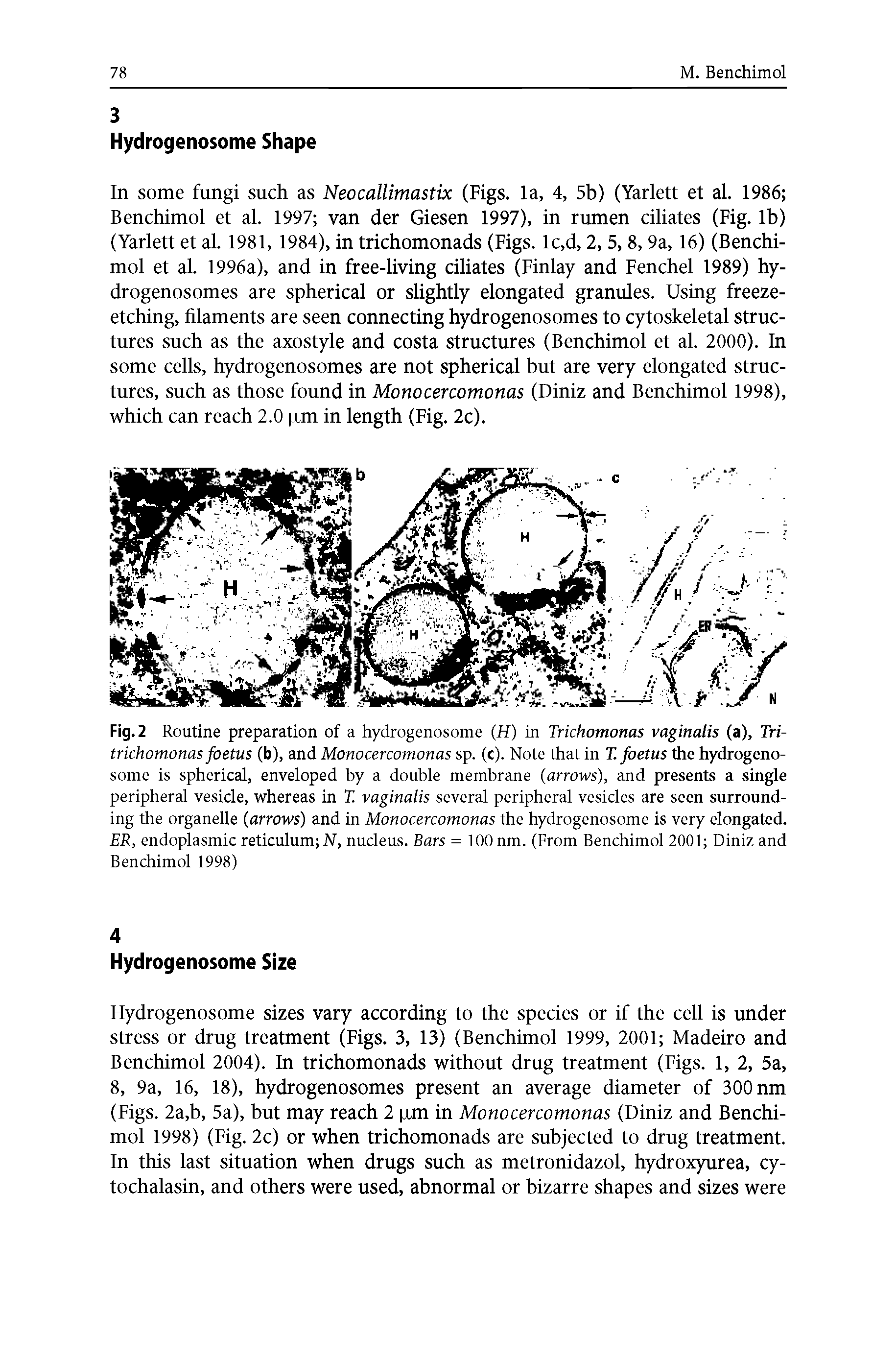 Fig. 2 Routine preparation of a hydrogenosome (H) in Trichomonas vaginalis (a), Tri-trichomonas foetus (b), and Monocercomonas sp. (c). Note that in T. foetus the hydrogenosome is spherical, enveloped by a double membrane (arrows), and presents a single peripheral vesicle, whereas in T vaginalis several peripheral vesicles are seen surrounding the organelle (arrows) and in Monocercomonas the hydrogenosome is very elongated. ER, endoplasmic reticulum N, nucleus. Bars = 100 nm. (From Benchimol 2001 Diniz and Benchimol 1998)...