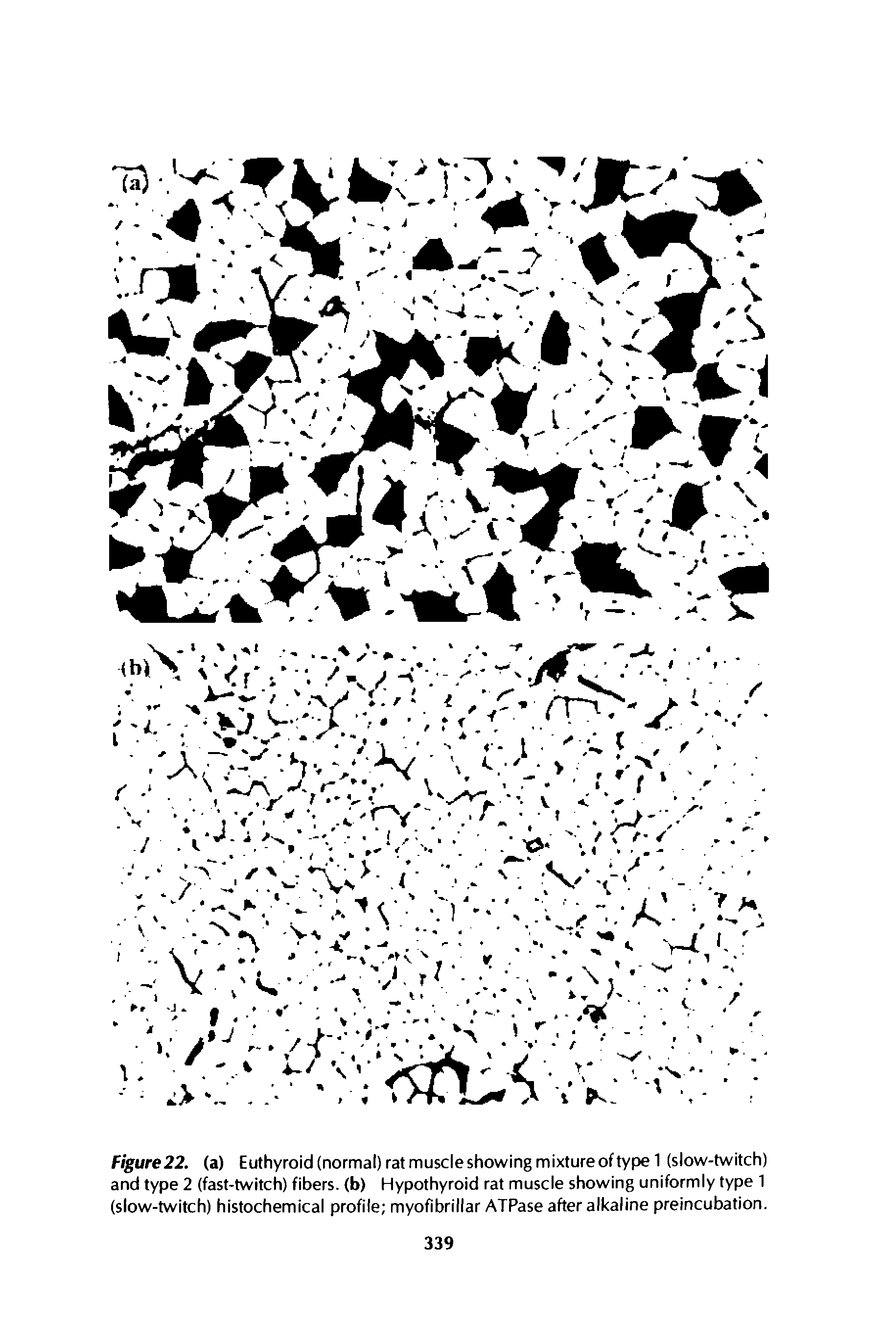 Figure22. (a) Euthyroid(normal)ratmuscleshowingmixtureoftype1 (slow-twitch) and type 2 (fast-twitch) fibers, (b) Hypothyroid rat muscle showing uniformly type 1 (slow-twitch) histochemical profile myofibrillar ATPase after alkaline preincubation.