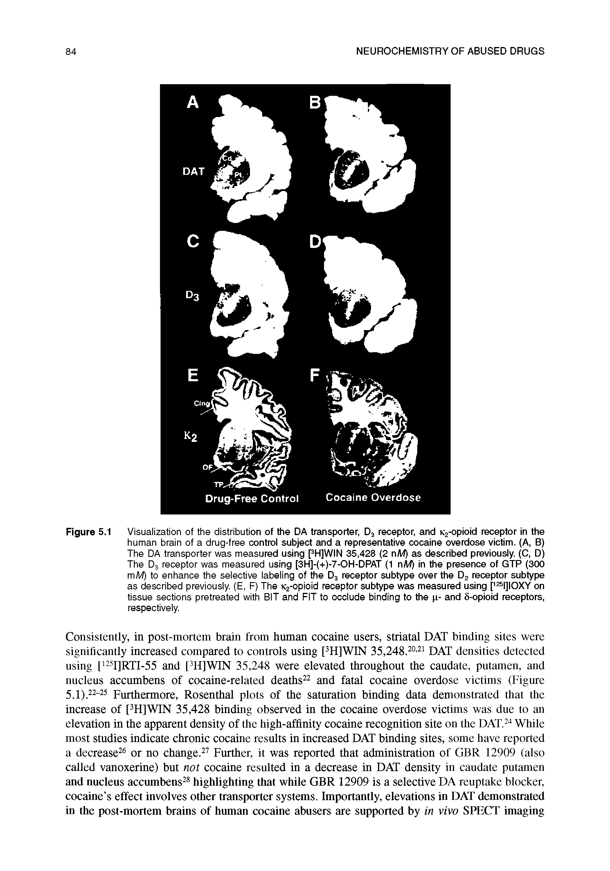 Figure 5.1 Visualization of the distribution of the DA transporter, D3 receptor, and K2-opioid receptor in the human brain of a drug-free control subject and a representative cocaine overdose victim. (A, B) The DA transporter was measured using [3H]WIN 35,428 (2 nM) as described previously. (C, D) The D3 receptor was measured using [3H]-(+)-7-OH-DPAT (1 nM) in the presence of GTP (300 m/W) to enhance the selective labeling of the D3 receptor subtype over the D2 receptor subtype as described previously. (E, F) The K2-opioid receptor subtype was measured using [125l]IOXY on tissue sections pretreated with BIT and FIT to occlude binding to the p- and 8-opioid receptors, respectively.