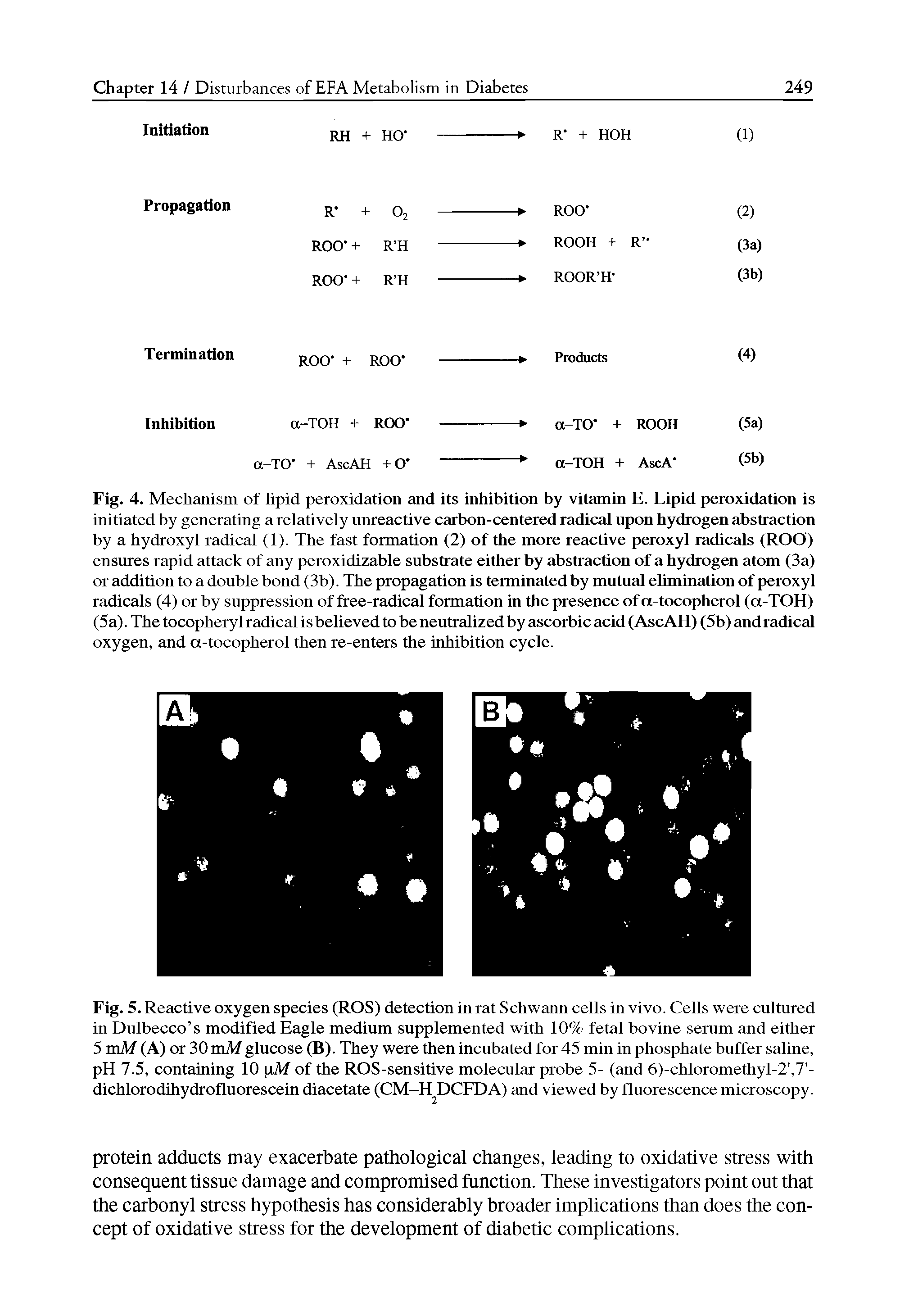 Fig. 5. Reactive oxygen species (ROS) detection in rat Schwann cells in vivo. Cells were cultured in Dulbecco s modified Eagle medium supplemented with 10% fetal bovine serum and either 5 vaM (A) or 30 vaM glucose (B). They were then incubated for 45 min in phosphate buffer saline, pH 7.5, containing 10 M of the ROS-sensitive molecular probe 5- (and 6)-chloromethyl-2, 7 -dichlorodihydrofluorescein diacetate (CM-H DCFD A) and viewed by fluorescence microscopy.