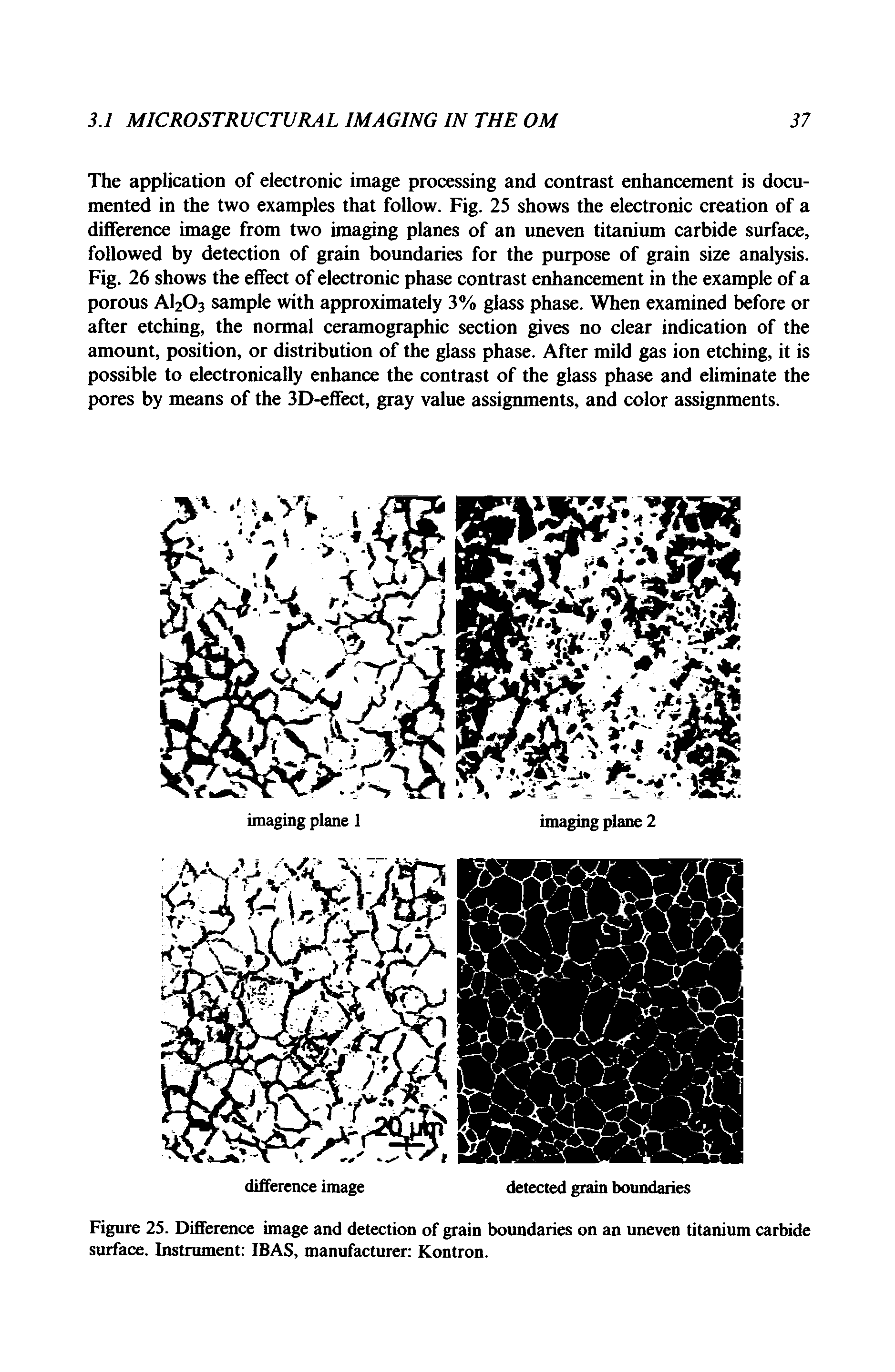 Figure 23. Difference image and detection of grain boundaries on an uneven titanium carbide surface. Instrument IBAS, manufacturer Kontron.