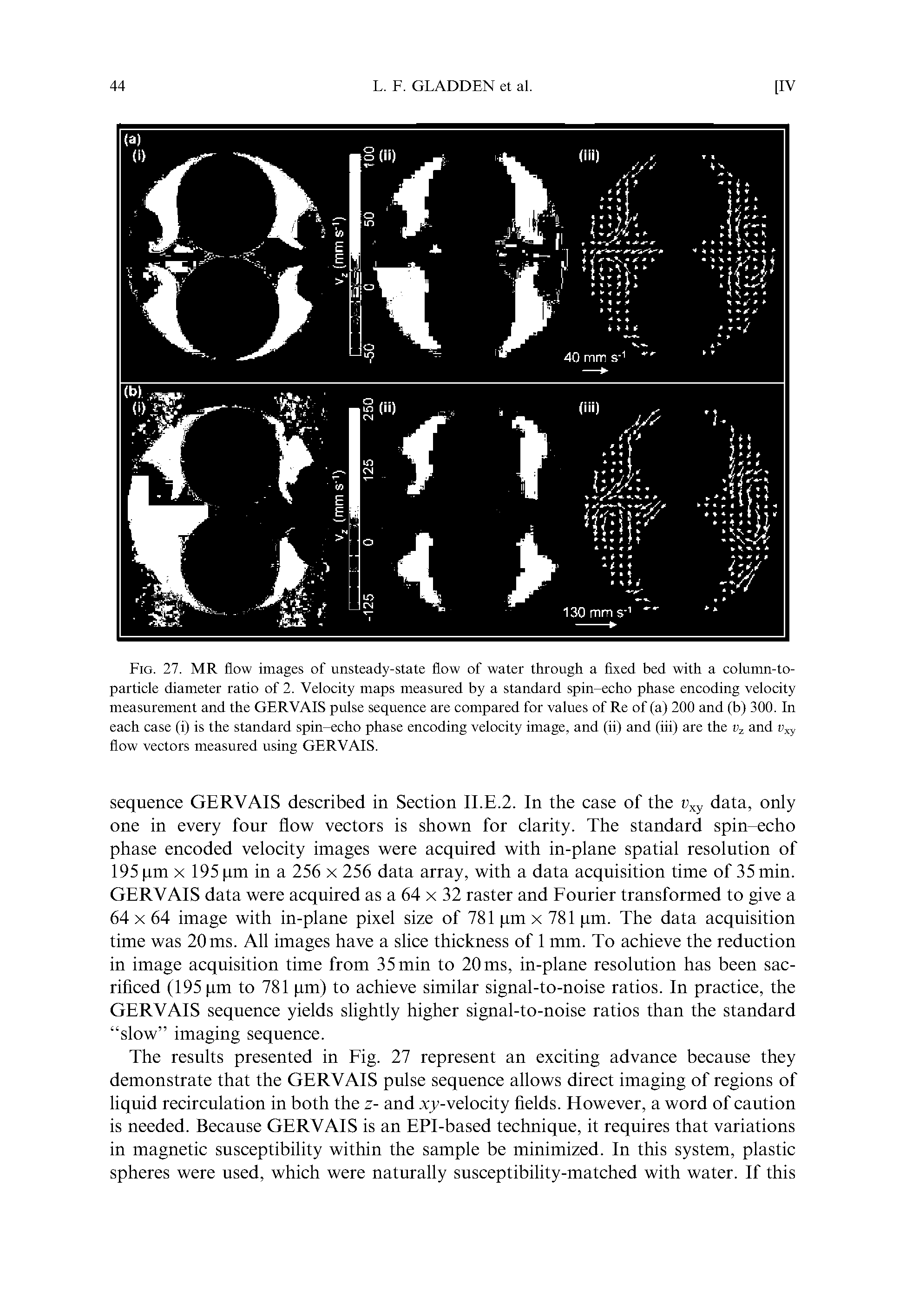 Fig. 27. MR flow images of unsteady-state flow of water through a fixed bed with a column-to-particle diameter ratio of 2. Velocity maps measured by a standard spin-echo phase encoding velocity measurement and the GERVAIS pulse sequence are compared for values of Re of (a) 200 and (b) 300. In each case (i) is the standard spin-echo phase encoding velocity image, and (ii) and (iii) are the and flow vectors measured using GERVAIS.