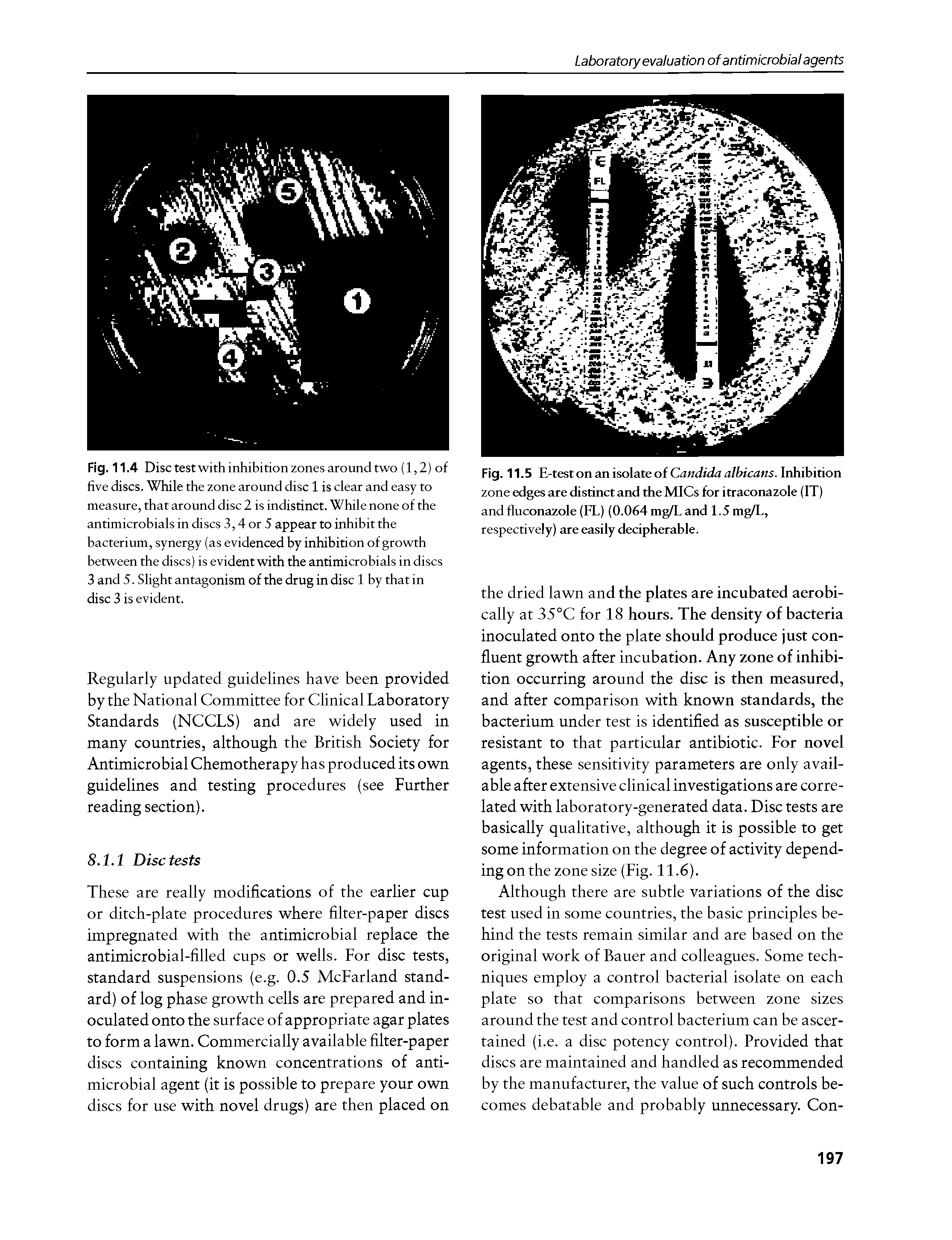 Fig. 11.4 Disc test with inhibition zones around two (1,2) of five discs. While the zone around disc 1 is clear and easy to measure, that around disc 2 is indistinct. While none of the antimicrobials in discs 3,4 or 5 appear to inhibit the bacterium, synergy (as evidenced by inhibition of growth between the discs) is evident with the antimicrobials in discs 3 and 5. Slight antagonism of the drug in disc 1 by that in disc 3 is evident.