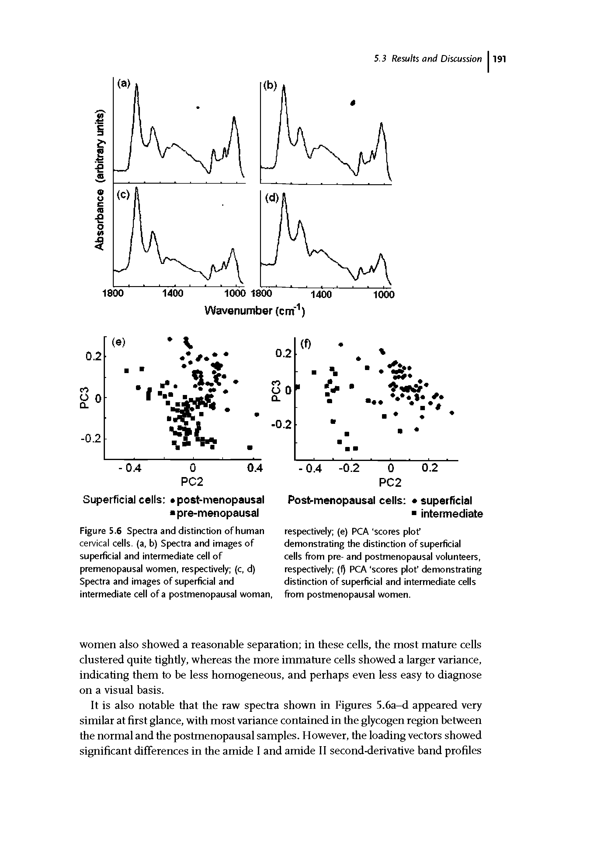 Figure 5.6 Spectra and distinction of human cervical cells, (a, b) Spectra and images of superficial and intermediate cell of premenopausal women, respectively (c, d) Spectra and images of superficial and intermediate cell of a postmenopausal woman,...