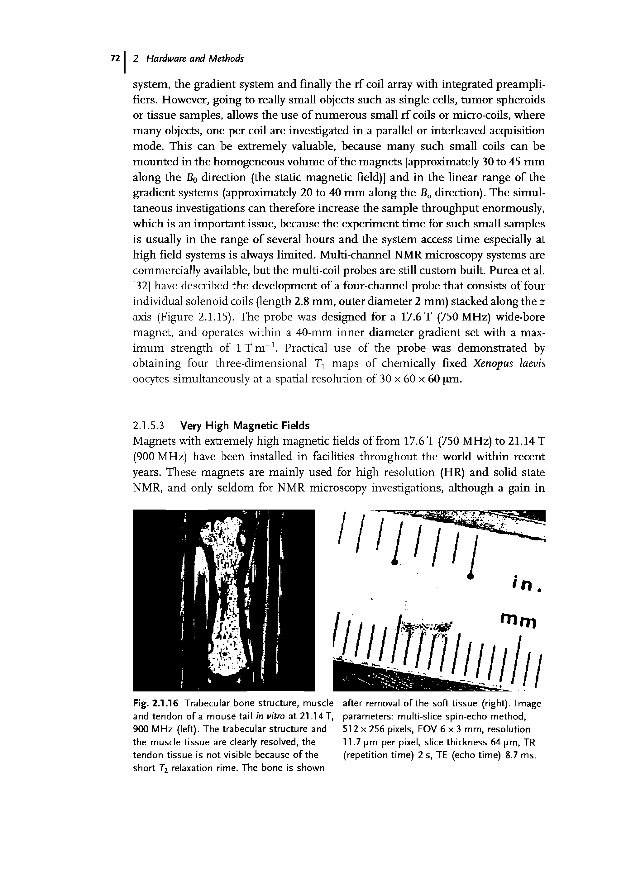 Fig. 2.1.16 Trabecular bone structure, muscle after removal of the soft tissue (right). Image and tendon of a mouse tail in vitro at 21.14T, parameters multi-slice spin-echo method,...