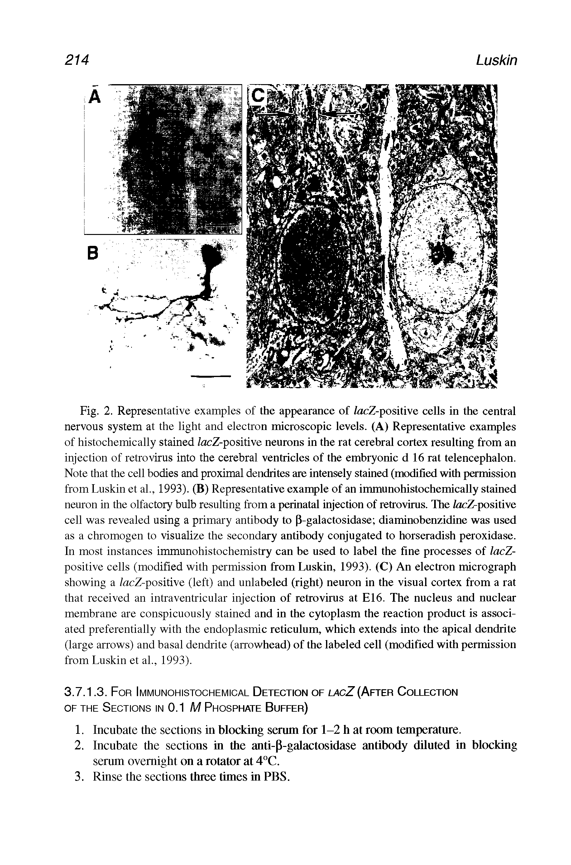 Fig. 2. Representative examples of the appearance of /ocZ-positive cells in the central nervous system at the light and electron microscopic levels. (A) Representative examples of histochemically stained lacZ-positive neurons in the rat cerebral cortex resulting from an injection of retrovirus into the cerebral ventricles of the embryonic d 16 rat telencephalon. Note that the cell bodies and proximal dendrites are intensely stained (modified with pamission from Luskin et al., 1993). (B) Representative example of an immunohistochemicaUy stained neuron in the olfactory bulb resulting Irom a perinatal injection of retrovirus. The IdcZ-positive cell was revealed using a primary antibody to P-galactosidase diaminobenzidine was used as a chromogen to visualize the secondary antibody conjugated to horseradish peroxidase. In most instances immunohistochemistry can be used to label the fine processes of lacZ-positive cells (modified with permission from Luskin, 1993). (C) An electron micrograph showing a ZacZ-positive (left) and unlabeled (right) neuron in the visual cortex from a rat that received an intraventricular injection of retrovirus at E16. The nucleus and nuclear membrane are conspicuously stained and in the cytoplasm the reaction product is associated preferentially with the endoplasmic reticulum, which extends into the apical dendrite (large arrows) and basal dendrite (arrowhead) of the labeled cell (modified with permission from Luskin et al., 1993).