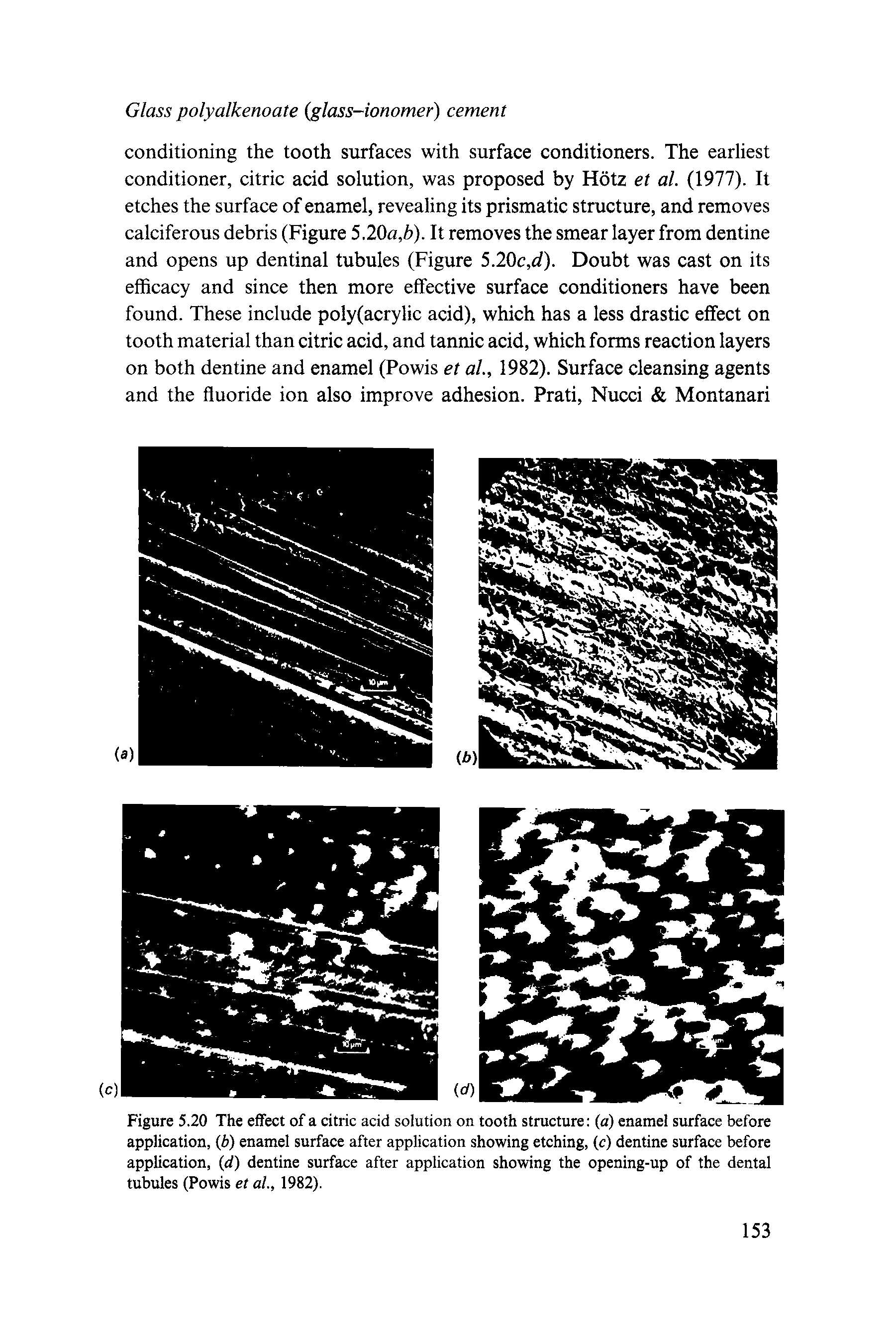 Figure 5.20 The effect of a citric acid solution on tooth structure (a) enamel surface before application, (b) enamel surface after application showing etching, (c) dentine surface before application, (d) dentine surface after application showing the opening-up of the dental tubules (Powis et al, 1982).