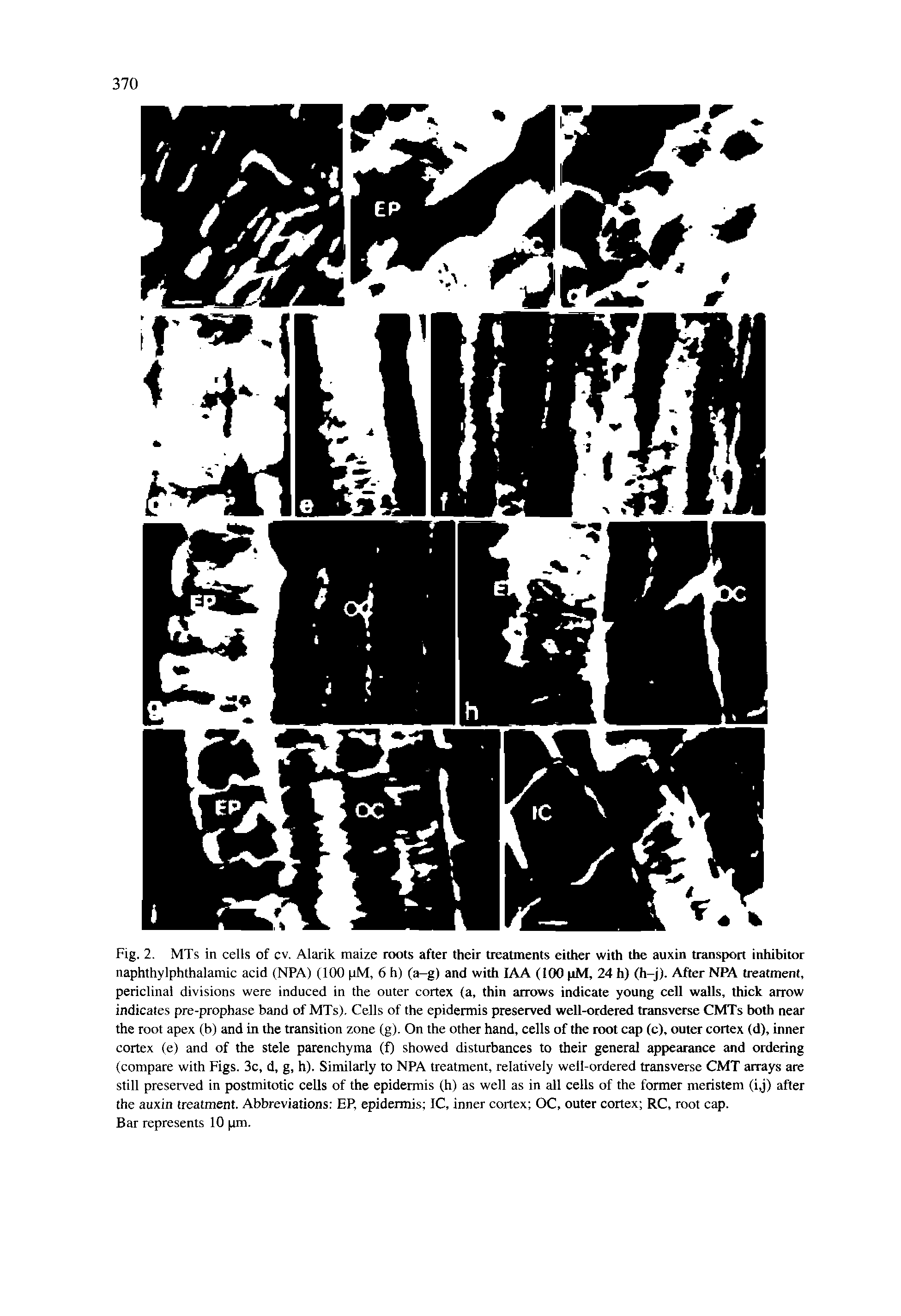 Fig. 2. MTs in cells of ev. Alarik maize roots after their treatments either with the auxin transport inhibitor naphthylphthalamic acid (NPA) (100 pM, 6 h) (a-g) and with lAA (100 pM, 24 h) (h-j). After NPA treatment, periclinal divisions were induced in the outer cortex (a, thin arrows indicate young cell walls, thick arrow indicates pre-prophase band of MTs). Cells of the epidermis preserved well-ordered transverse CMTs both near the root apex (b) and in the transition zone (g). On the other hand, cells of the root cap (c), outer cortex (d), inner cortex (e) and of the stele parenchyma (f) showed disturbances to their general appearance and ordering (compare with Figs. 3c, d, g, h). Similarly to NPA treatment, relatively well-ordered transverse CMT arrays are still preserved in postmitotic cells of the epidermis (h) as well as in all cells of the former meristem (i,j) after the auxin treatment. Abbreviations EP, epidermis IC, inner cortex OC, outer cortex RC, root cap.