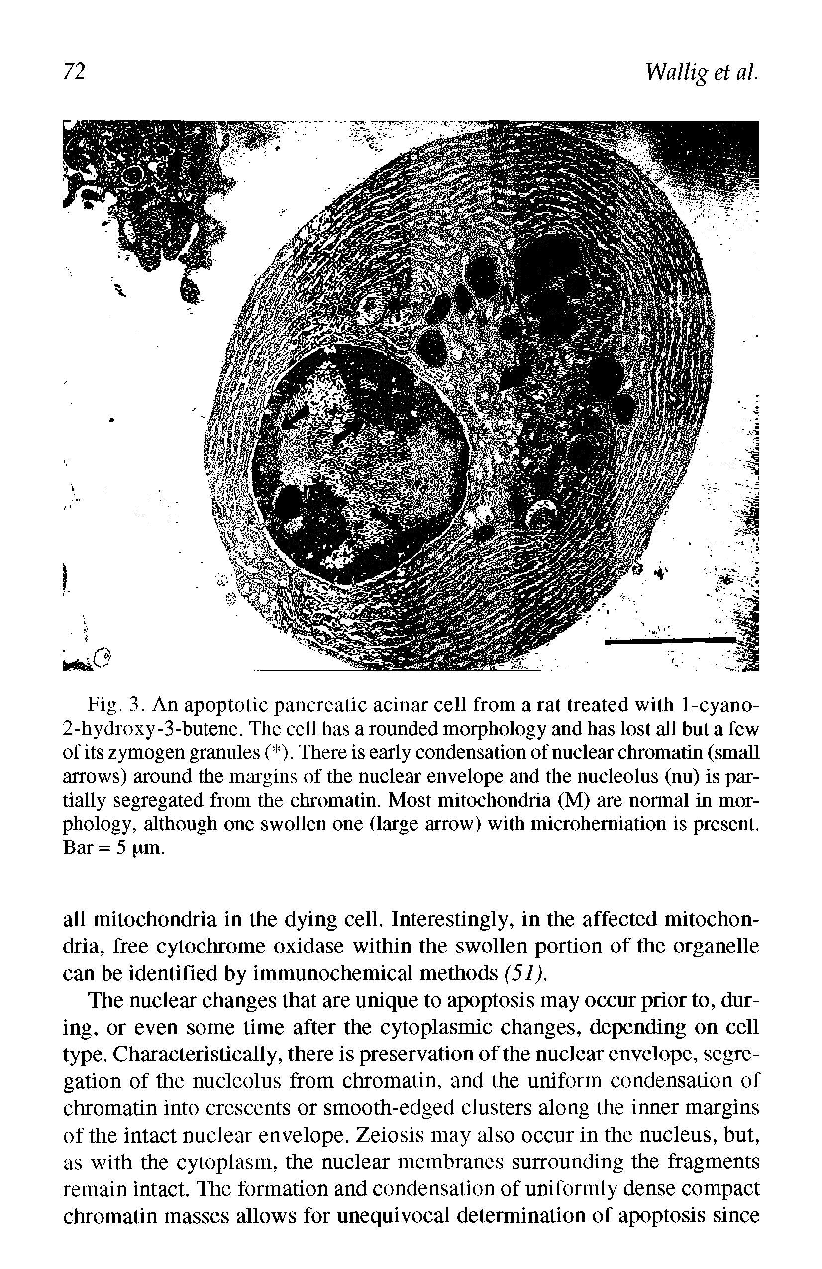 Fig. 3. An apoptotic pancreatic acinar cell from a rat treated with 1-cyano-2-hydroxy-3-butene. The cell has a rounded morphology and has lost all but a few of its zymogen granules ( ). There is early condensation of nuclear chromatin (small arrows) around the margins of the nuclear envelope and the nucleolus (nu) is partially segregated from the chromatin. Most mitochondria (M) are normal in morphology, although one swollen one (large arrow) with microhemiation is present. Bar = 5 pm.