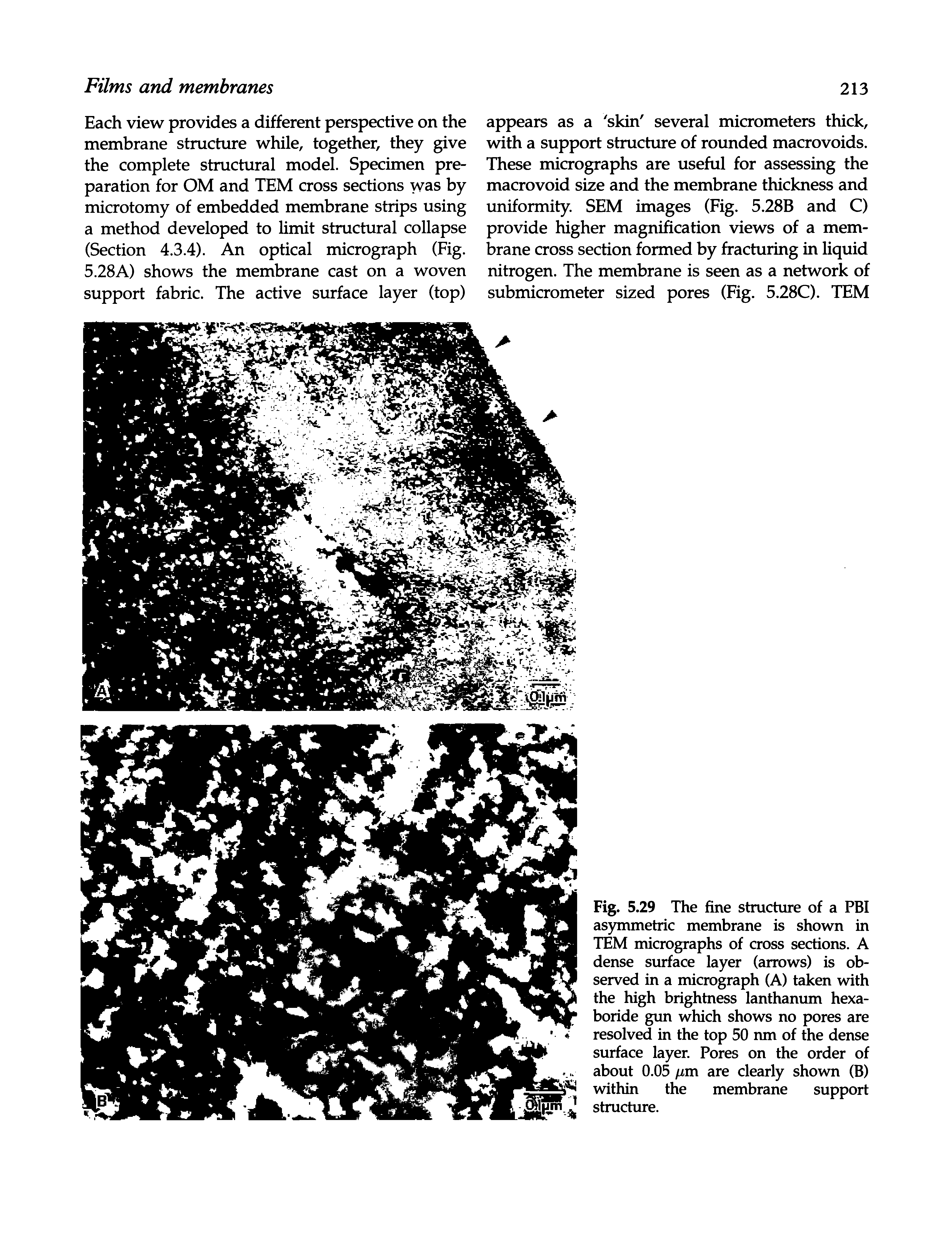 Fig. 5.29 The fine structure of a FBI asymmetric membrane is shown in TEM micrographs of cross sections. A dense surface layer (arrows) is observed in a nucrograph (A) taken with the high brightness lanthanum hexa-boride gun which shows no pores are resolved in the top 50 nm of the dense surface layer. Pores on the order of about 0.05 //m are clearly shown (B) within the membrane support structure.