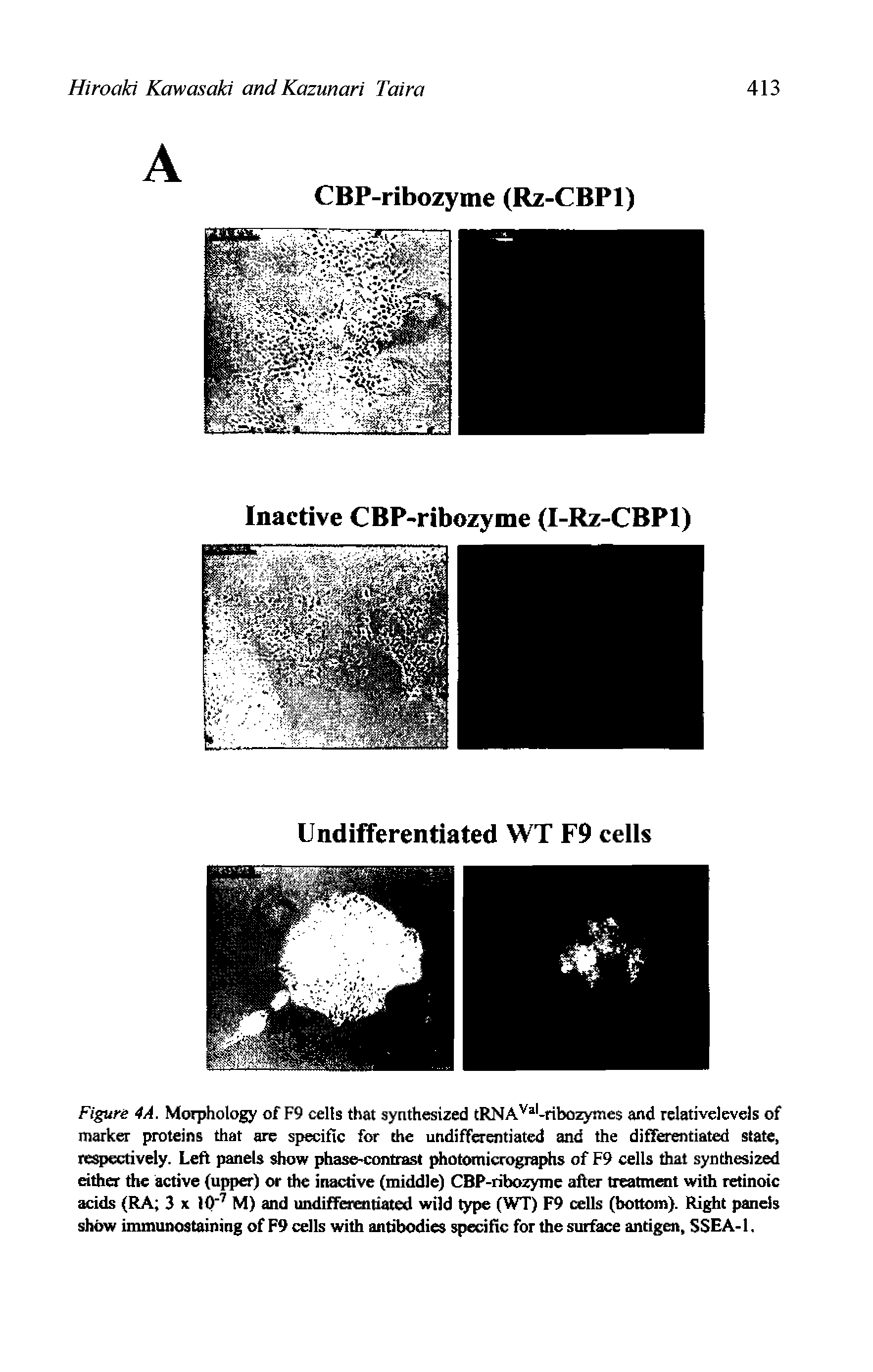 Figure 4A. Morphology of F9 cells that synthesized tRNA -ribozymes and rclativelevels of marker proteins that are s[>ecific for the undifferentiated and the differentiated state, respectively. Left panels show phase Contrast photomicrographs of F9 cells that synthesized either the active (upper) or the inactive (middle) CBP-ribozyme after treatmmt with retinoic adds (RA 3 x U) M) and imdifFeientiated wild type (WT) F9 cells (bottom). Right pands show immunostaining of F9 cells with antibodies spedfic for the surtoce antigen, SSEA-1.