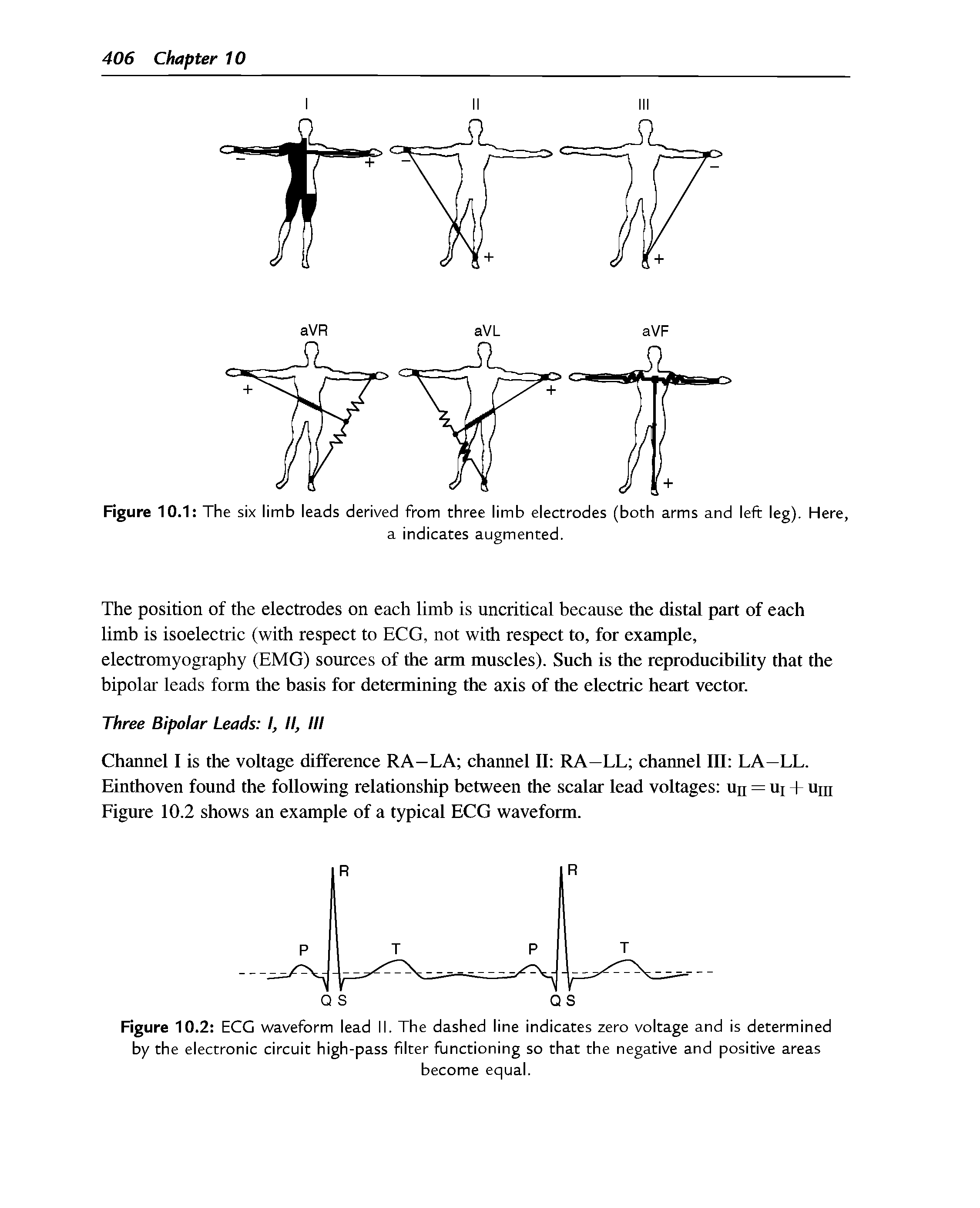 Figure 10.1 The six limb leads derived from three limb electrodes (both arms and left leg). Here,...