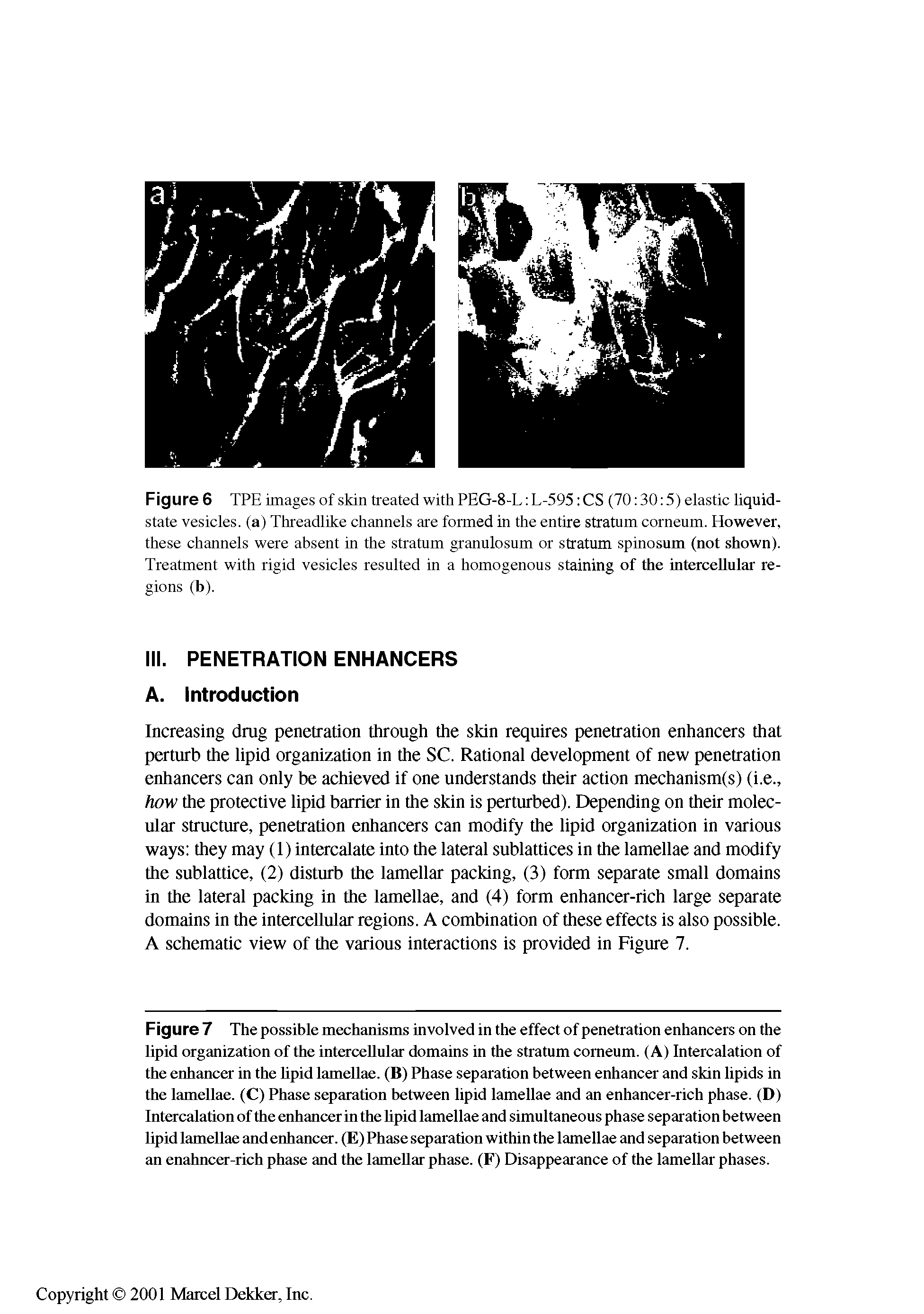 Figure 7 The possible mechanisms involved in the effect of penetration enhancers on the lipid organization of the intercellular domains in the stratum corneum. (A) Intercalation of the enhancer in the lipid lamellae. (B) Phase separation between enhancer and skin lipids in the lamellae. (C) Phase separation between lipid lamellae and an enhancer-rich phase. (D) Intercalation of the enhancer in the lipid lamellae and simultaneous phase separation between lipid lamellae and enhancer. (E) Phase separation within the lamellae and separation between an enahncer-rich phase and the lamellar phase. (F) Disappearance of the lamellar phases.