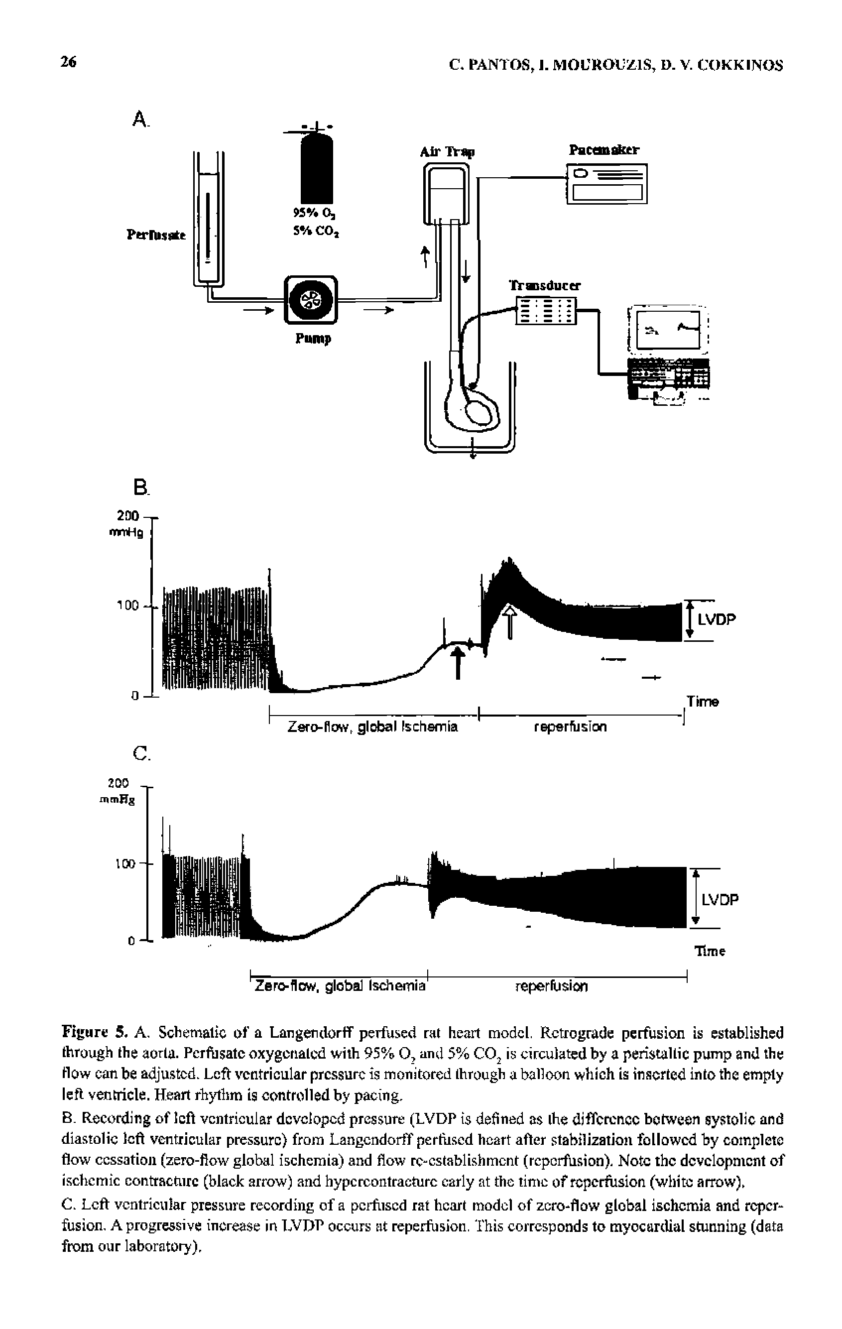 Figure 5. A, Schematic of a Largerdortf perfused rat heart model. Retrograde perfusion is established through the aorta. Perfusate oxygenated with 95% O, and 5% CO, is circulated by a peristaltic pump and the flow can be adjusted. Left ventricular pressure is monitored Ihrough a balloon which is inserted into the empty left ventricle. Heart rhythm is controlled by pacing.