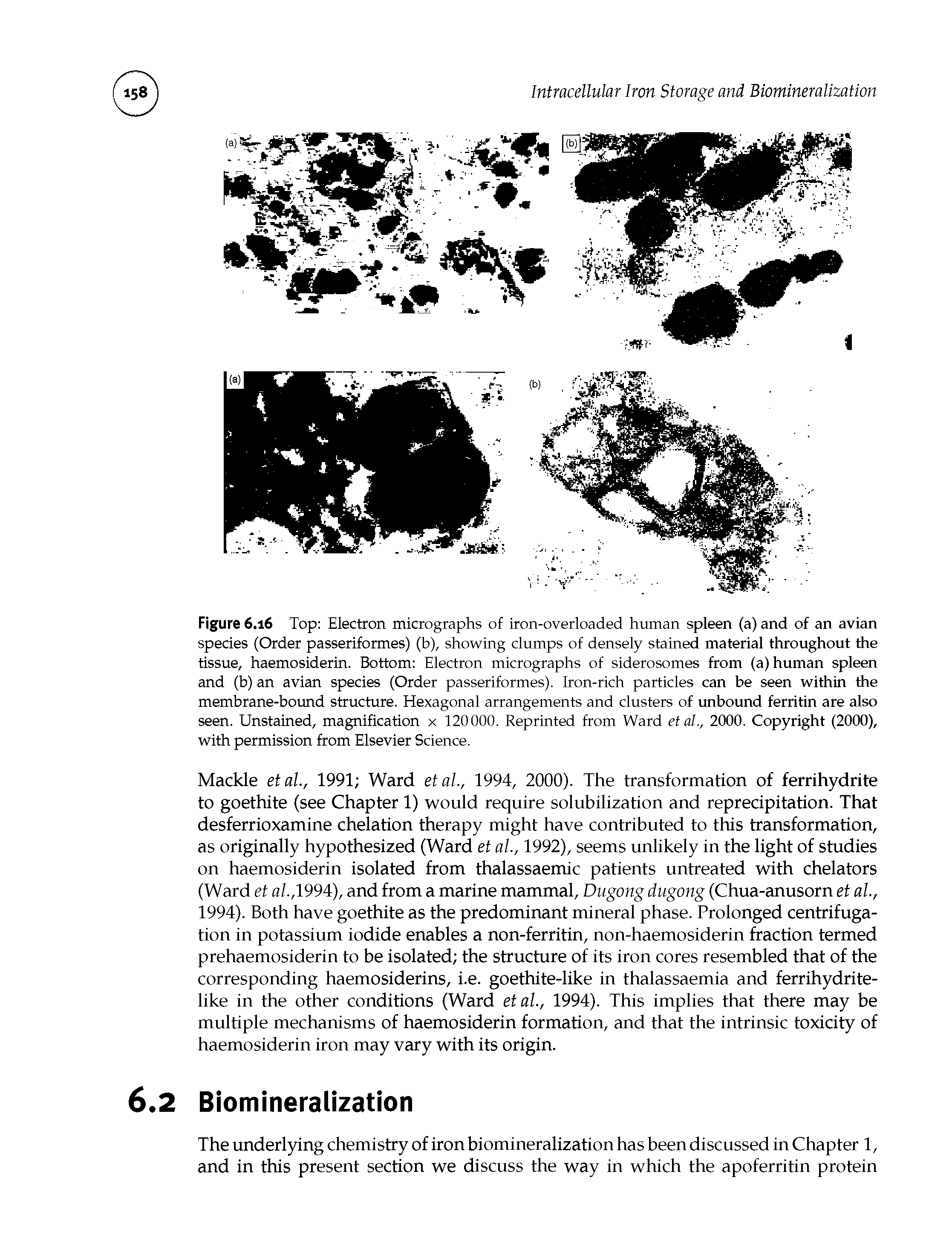 Figure 6.16 Top Electron micrographs of iron-overloaded human spleen (a) and of an avian species (Order passeriformes) (b), showing clumps of densely stained material throughout the tissue, haemosiderin. Bottom Electron micrographs of siderosomes from (a) human spleen and (b) an avian species (Order passeriformes). Iron-rich particles can be seen within the membrane-bound structure. Hexagonal arrangements and clusters of unbound ferritin are also seen. Unstained, magnification x 120000. Reprinted from Ward etal., 2000. Copyright (2000), with permission from Elsevier Science.