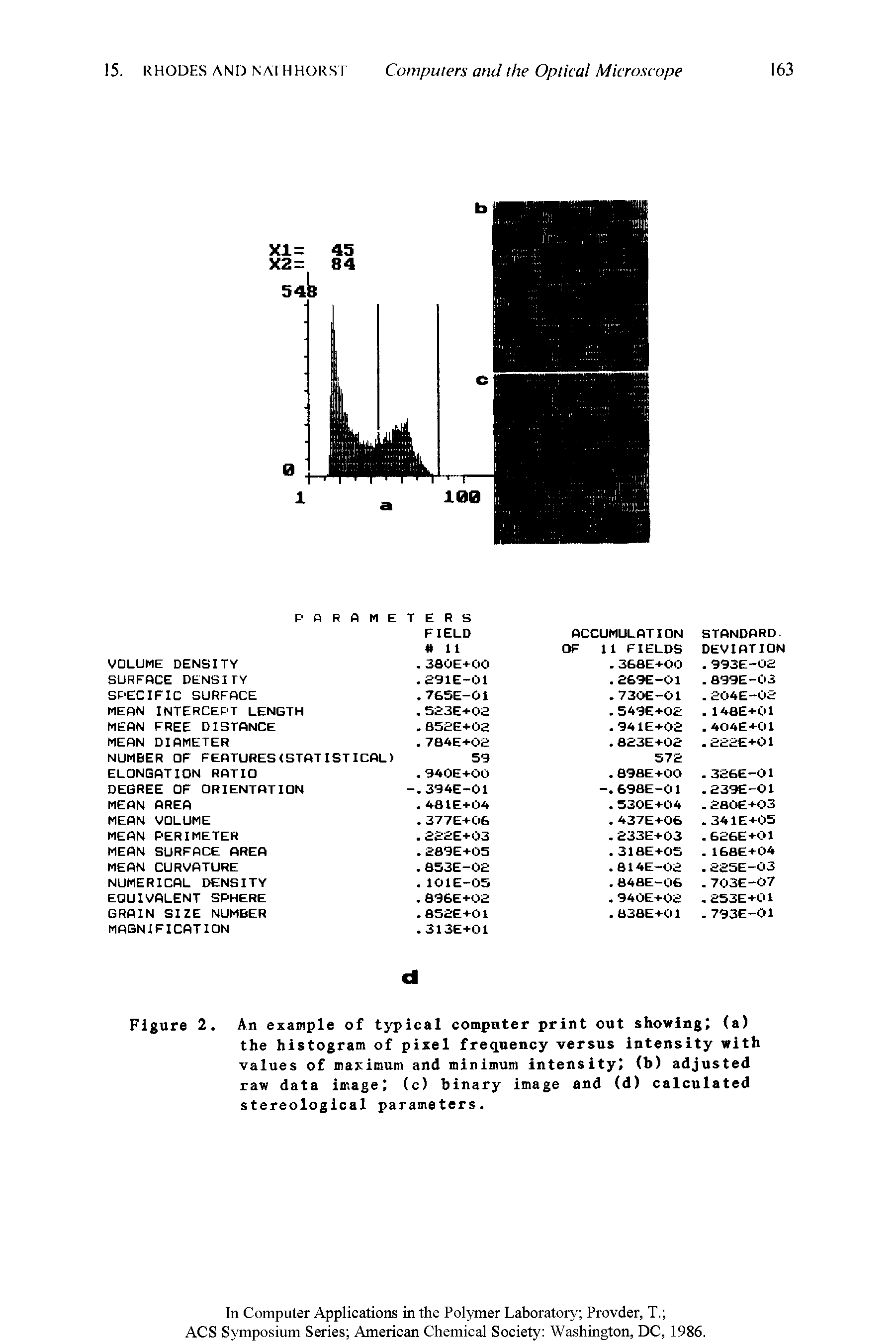 Figure 2. An example of typical computer print out showing (a) the histogram of pixel frequency versus intensity with values of maximum and minimum intensity (b) adjusted raw data image (c) binary image and (d) calculated stereological parameters.