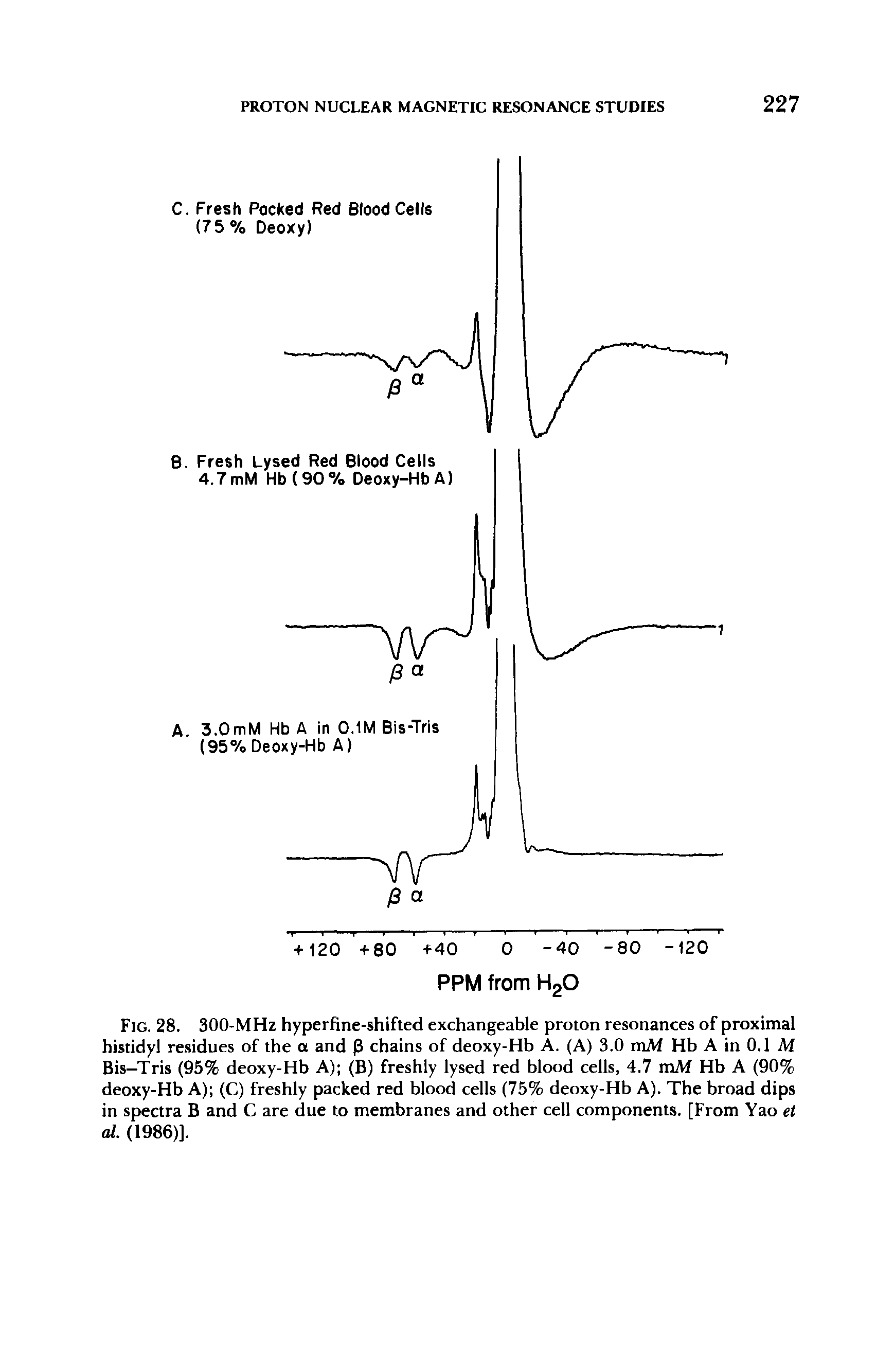 Fig. 28. 300-MHz hyperfine-shifted exchangeable proton resonances of proximal histidyl residues of the a and 0 chains of deoxy-Hb A. (A) 3.0 mM Hb A in 0.1 M Bis—Tris (95% deoxy-Hb A) (B) freshly lysed red blood cells, 4.7 mM Hb A (90% deoxy-Hb A) (C) freshly packed red blood cells (75% deoxy-Hb A). The broad dips in spectra B and C are due to membranes and other cell components. [From Yao et al. (1986)].