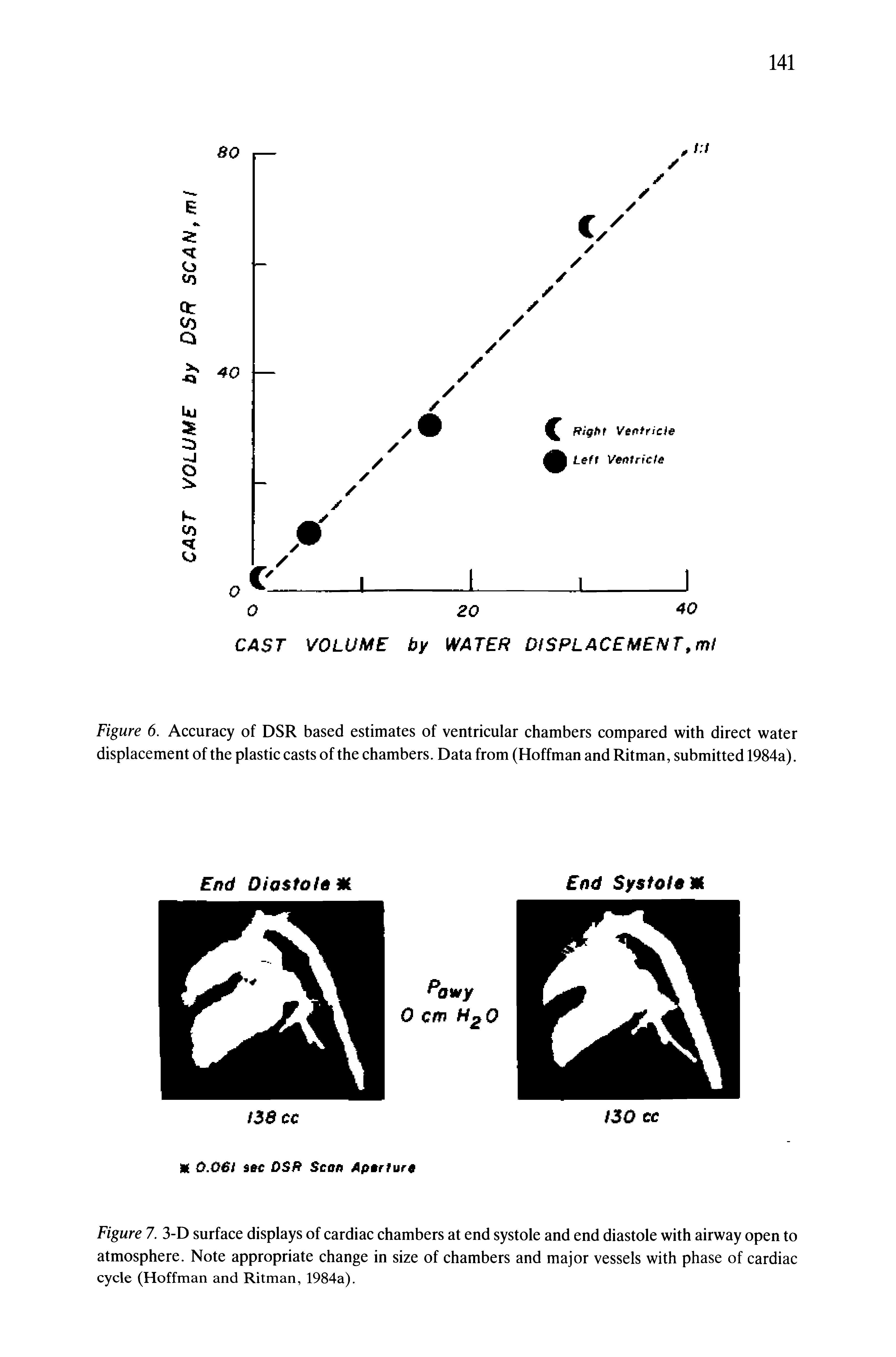 Figure 6. Accuracy of DSR based estimates of ventricular chambers compared with direct water displacement of the plastic casts of the chambers. Data from (Hoffman and Ritman, submitted 1984a).