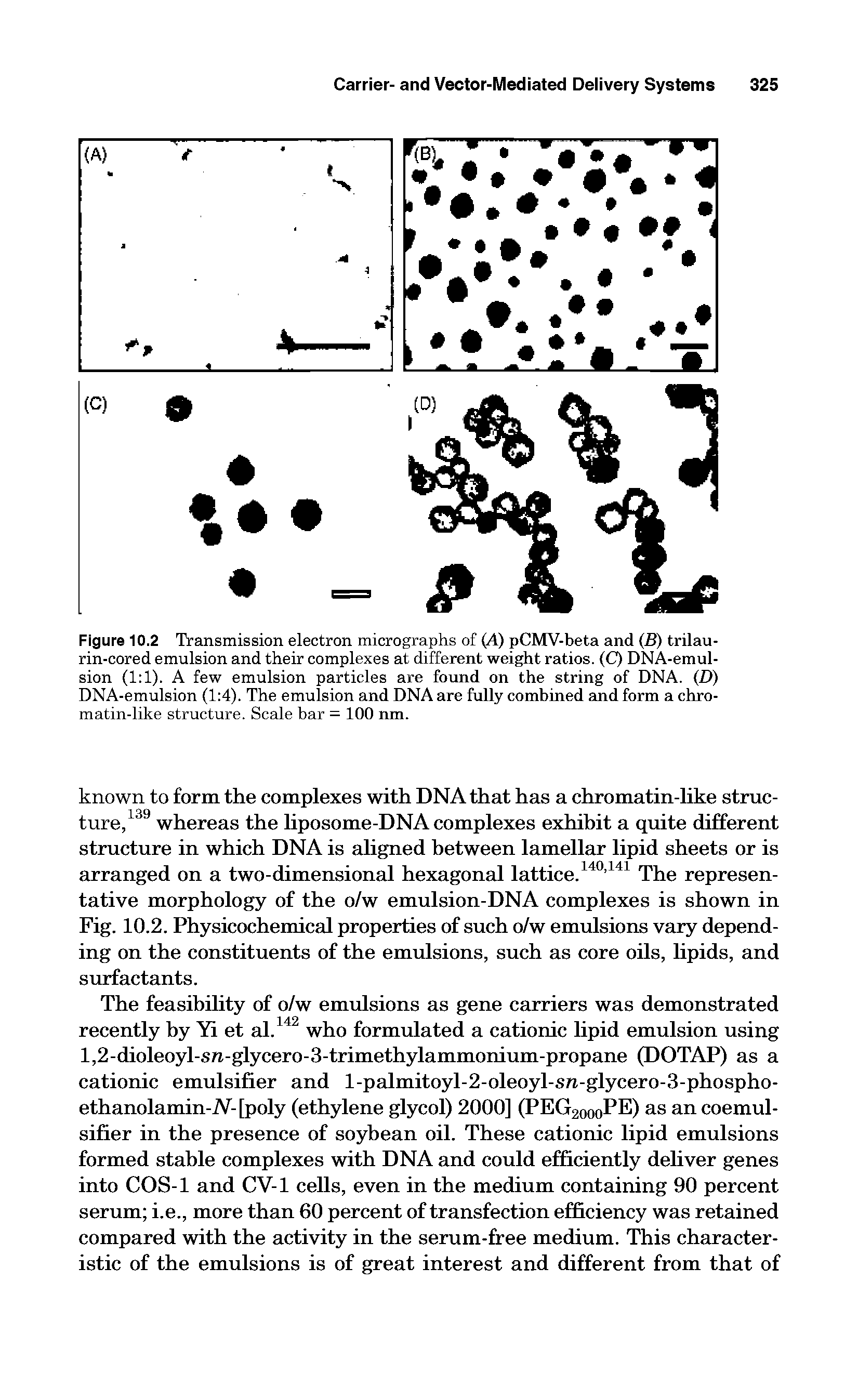 Figure 10.2 Transmission electron micrographs of (A) pCMV-beta and (B) trilau-rin-cored emulsion and their complexes at different weight ratios. (C) DNA-emul-sion (1 1). A few emulsion particles are found on the string of DNA. (D) DNA-emulsion (1 4). The emulsion and DNA are fully combined and form a chromatin-like structure. Scale bar = 100 nm.
