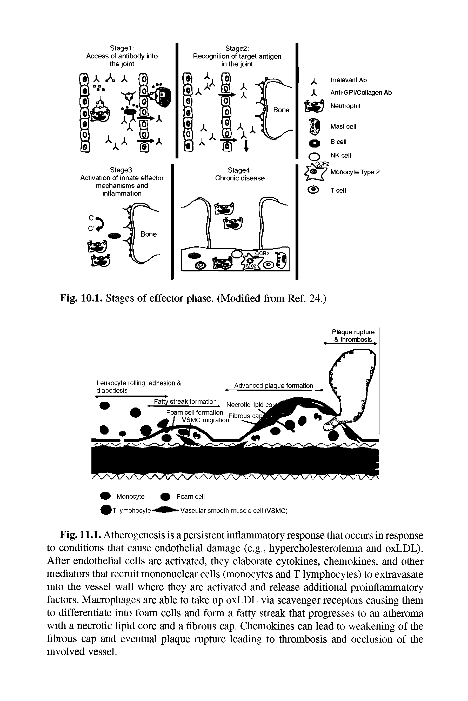 Fig. 11.1. Atherogenesis is a persistent inflammatory response that occurs in response to conditions that cause endothelial damage (e.g., hypercholesterolemia and oxLDL). After endothelial cells are activated, they elaborate cytokines, chemokines, and other mediators that recruit mononuclear cells (monocytes and T lymphocytes) to extravasate into the vessel wall where they are activated and release additional proinflammatory factors. Macrophages are able to take up oxLDL via scavenger receptors causing them to differentiate into foam cells and form a fatty streak that progresses to an atheroma with a necrotic lipid core and a fibrous cap. Chemokines can lead to weakening of the fibrous cap and eventual plaque rupture leading to thrombosis and occlusion of the involved vessel.