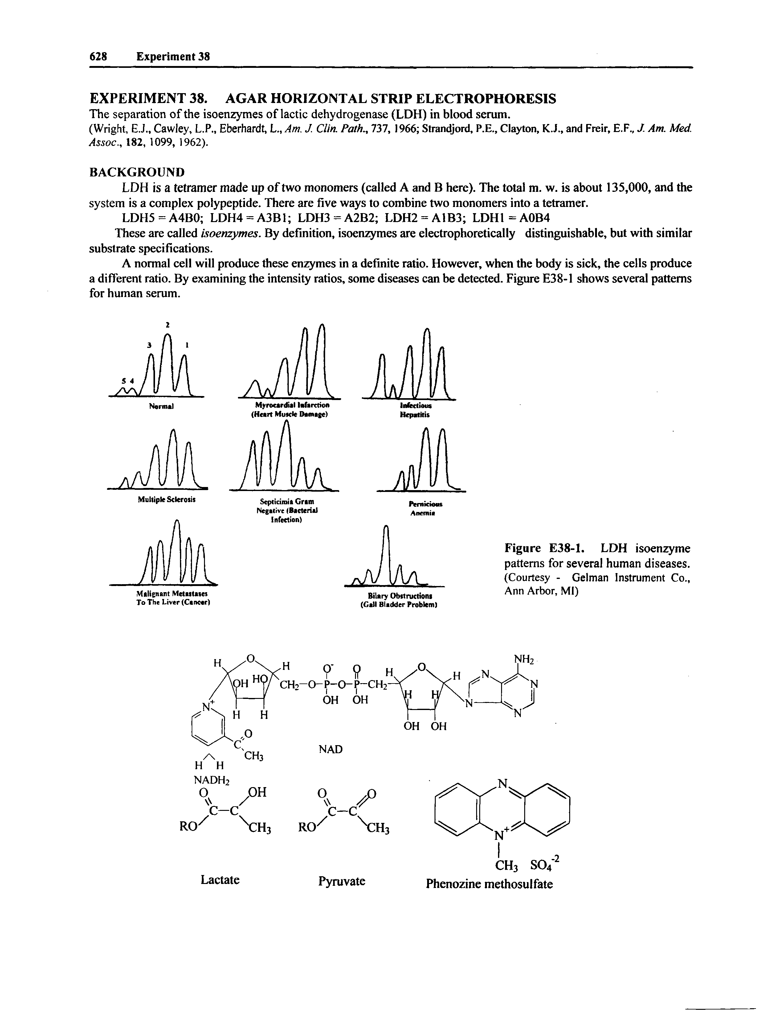 Figure E38-1. LDH isoenzyme patterns for several human diseases. (Courtesy - Gelman Instrument Co., Ann Arbor, Ml)...