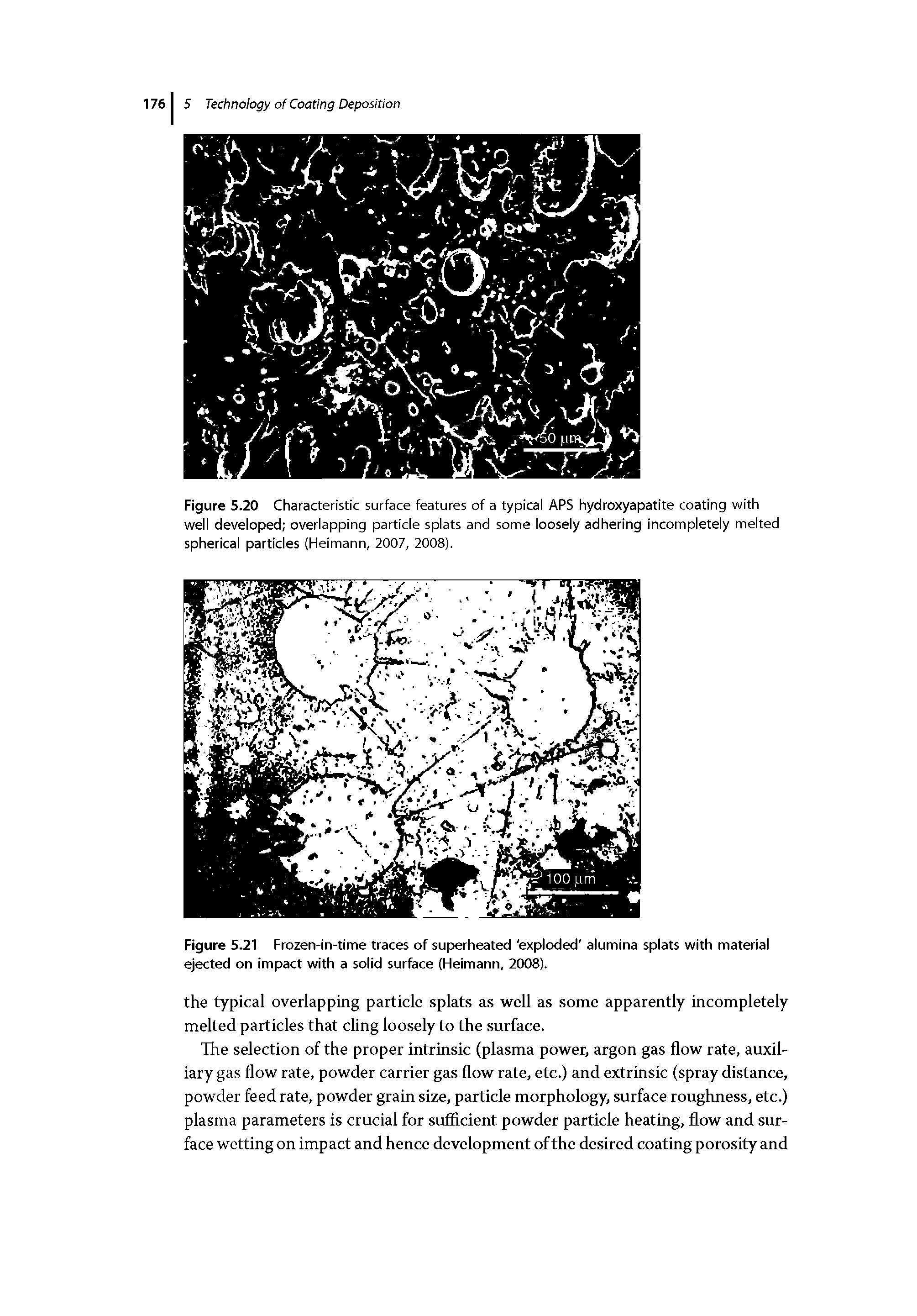 Figure 5.20 Characteristic surface features of a typical APS hydroxyapatite coating with well developed overlapping particle splats and some loosely adhering incompletely melted spherical particles (Heimann, 2007, 2008).