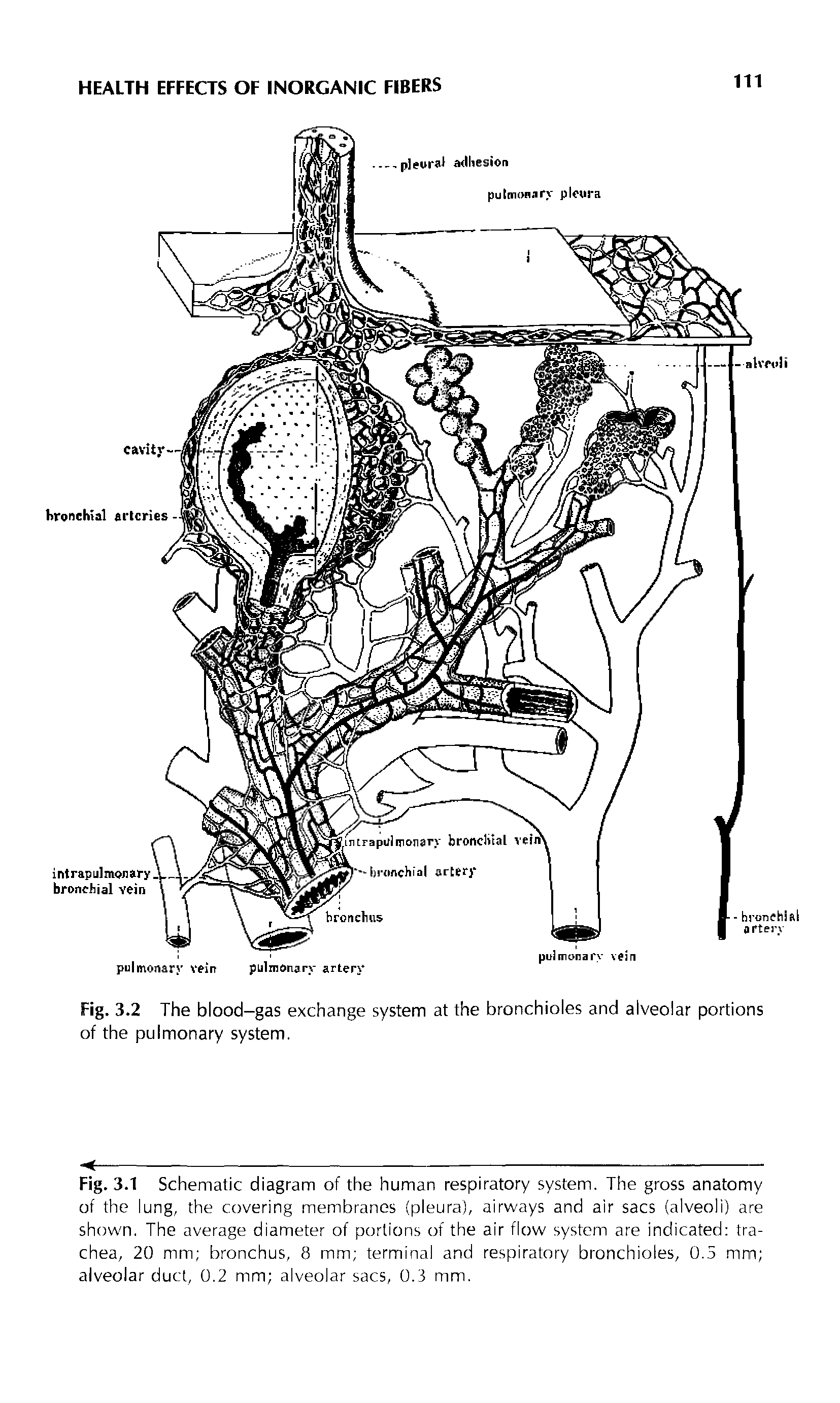 Fig. 3.1 Schematic diagram of the human respiratory system. The gross anatomy of the lung, the covering membranes (pleura), airways and air sacs (alveoli) are shown. The average diameter of portions of the air flow system are indicated trachea, 20 mm bronchus, 8 mm terminal and respiratory bronchioles, 0.5 mnn alveolar duct, 0.2 mm alveolar sacs, 0.3 mm.
