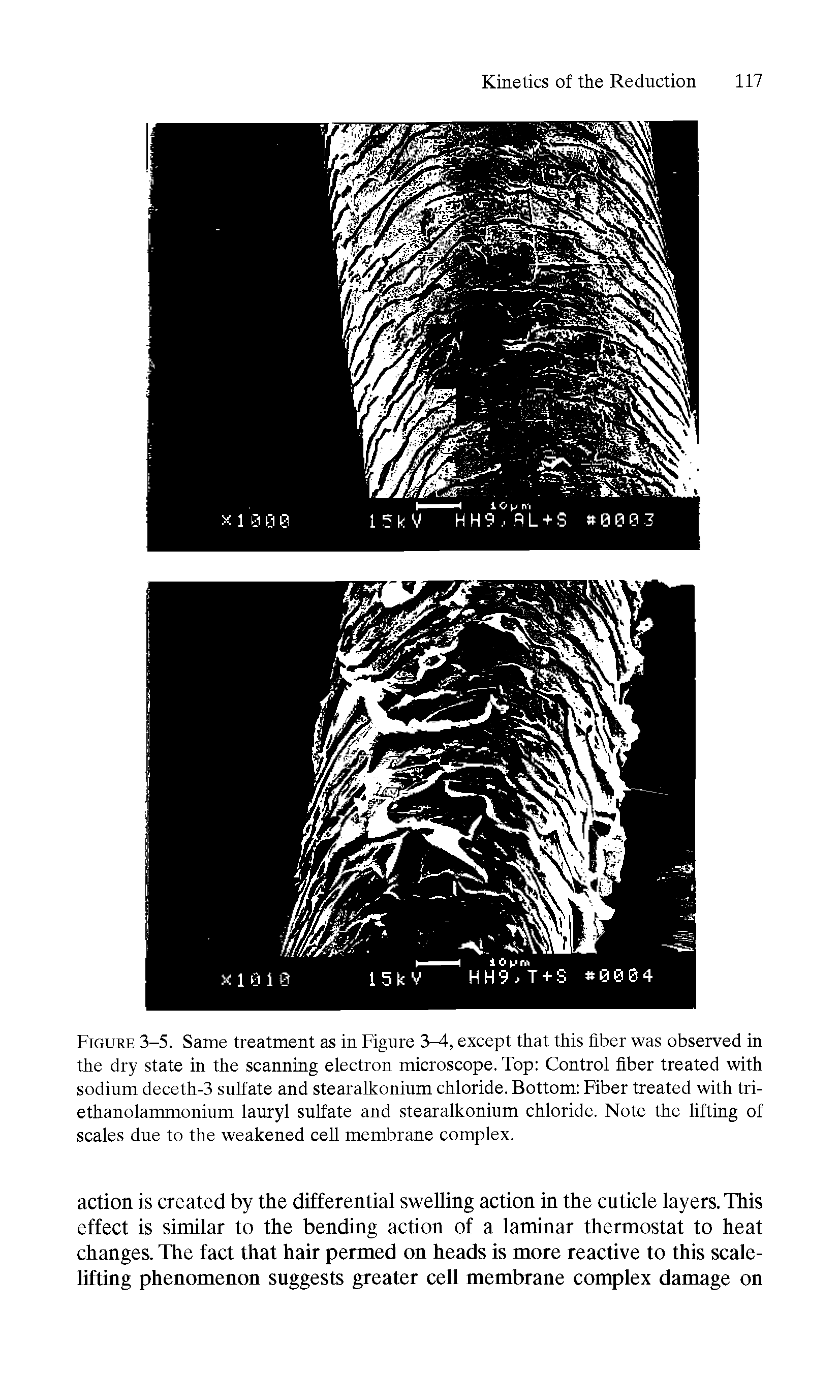 Figure 3-5. Same treatment as in Figure 3, except that this fiber was observed in the dry state in the scanning electron microscope. Top Control fiber treated with sodium deceth-3 sulfate and stearalkonium chloride. Bottom Fiber treated with tri-ethanolammonium lauryl sulfate and stearalkonium chloride. Note the lifting of scales due to the weakened cell membrane complex.