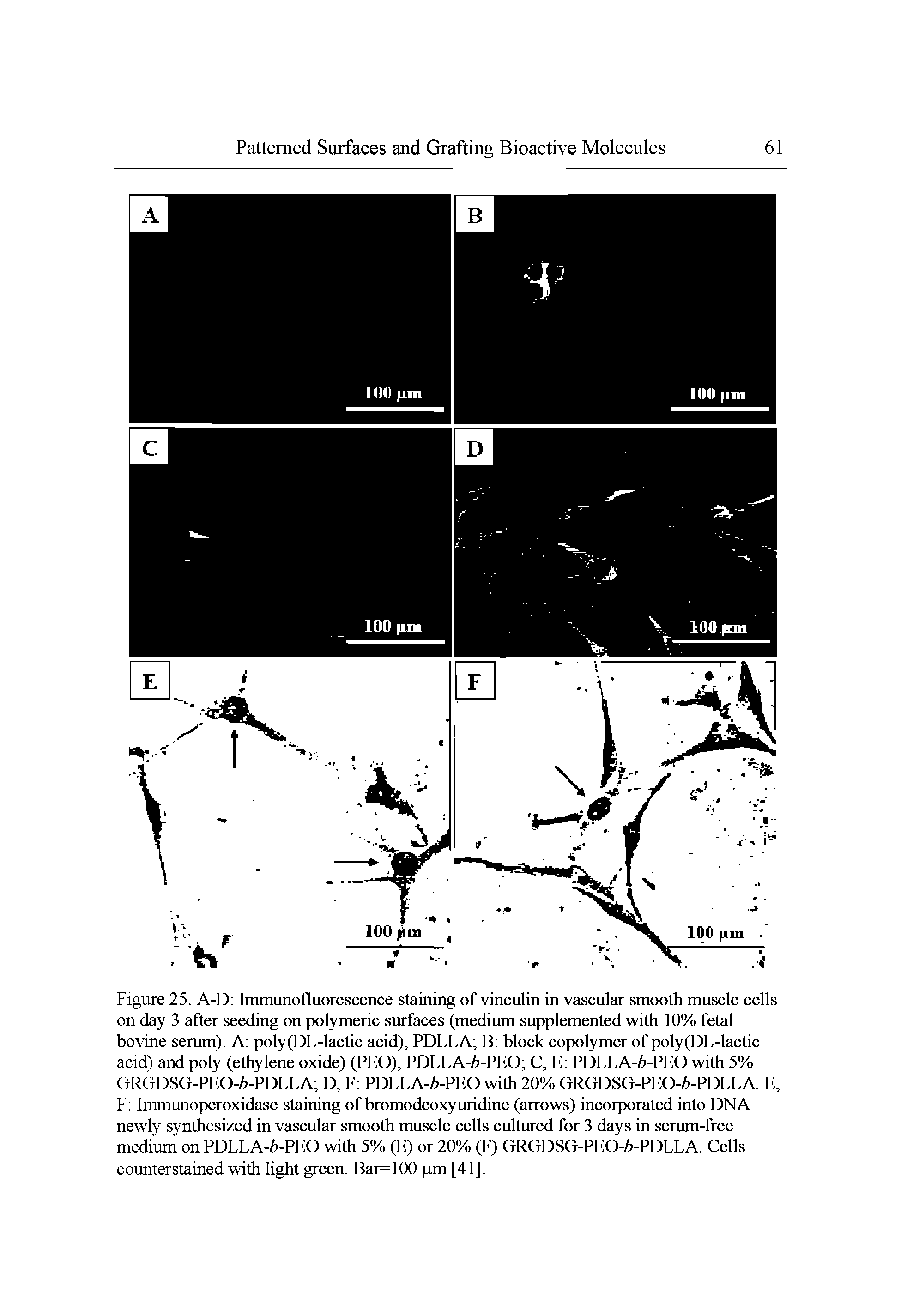 Figure 25. A-D Immunofluorescence staining of vmculrn in vascular smooth muscle cells on day 3 after seeding on polymeric surfaces (medium supplemented with 10% fetal bovine serum). A poly(DL-lactic acid), PDLLA B block copolymer of poly(DL-lactic acid) and poly (ethylene oxide) (PEO), PDLLA-6-PEO C, E PDLLA-6-PEO with 5% GRGDSG-PEO-6-PDLLA D, F PDLLA-6-PEO with 20% GRGDSG-PEO-6-PDLLA. E, F Immunoperoxidase staining of bromodeoxyuridine (arrows) incorporated into DNA newly synthesized in vascular smooth muscle cells cultured for 3 days in serum-free medium on PDLLA-Z)-PEO with 5% (E) or 20% (F) GRGDSG-PEO-6-PDLLA. Cells counterstained with light green. Bar=100 pm [41].