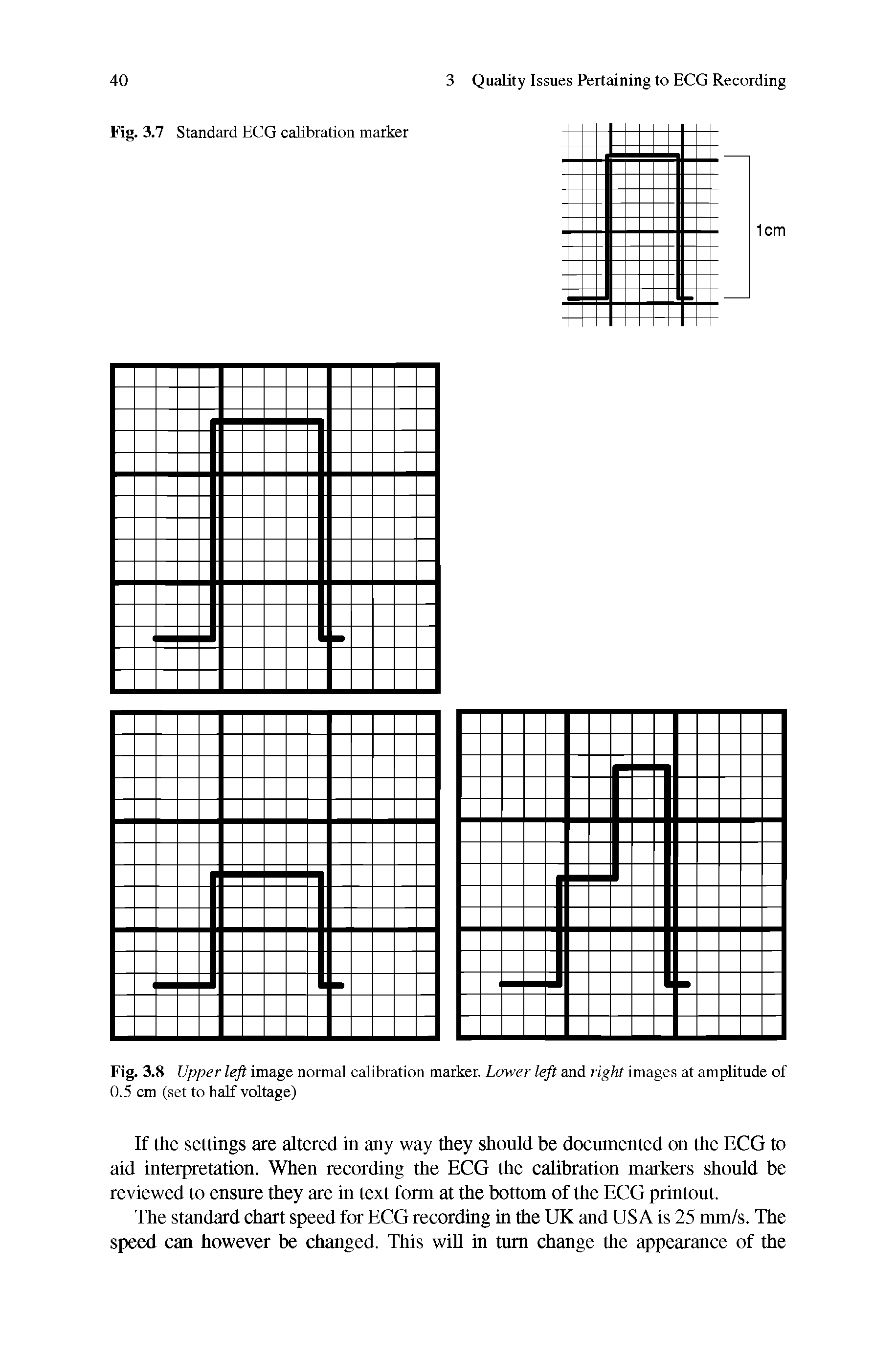 Fig. 3.8 Upper left image normal calibration marker. Lower left and right images at amplitude of 0.5 cm (set to half voltage)...