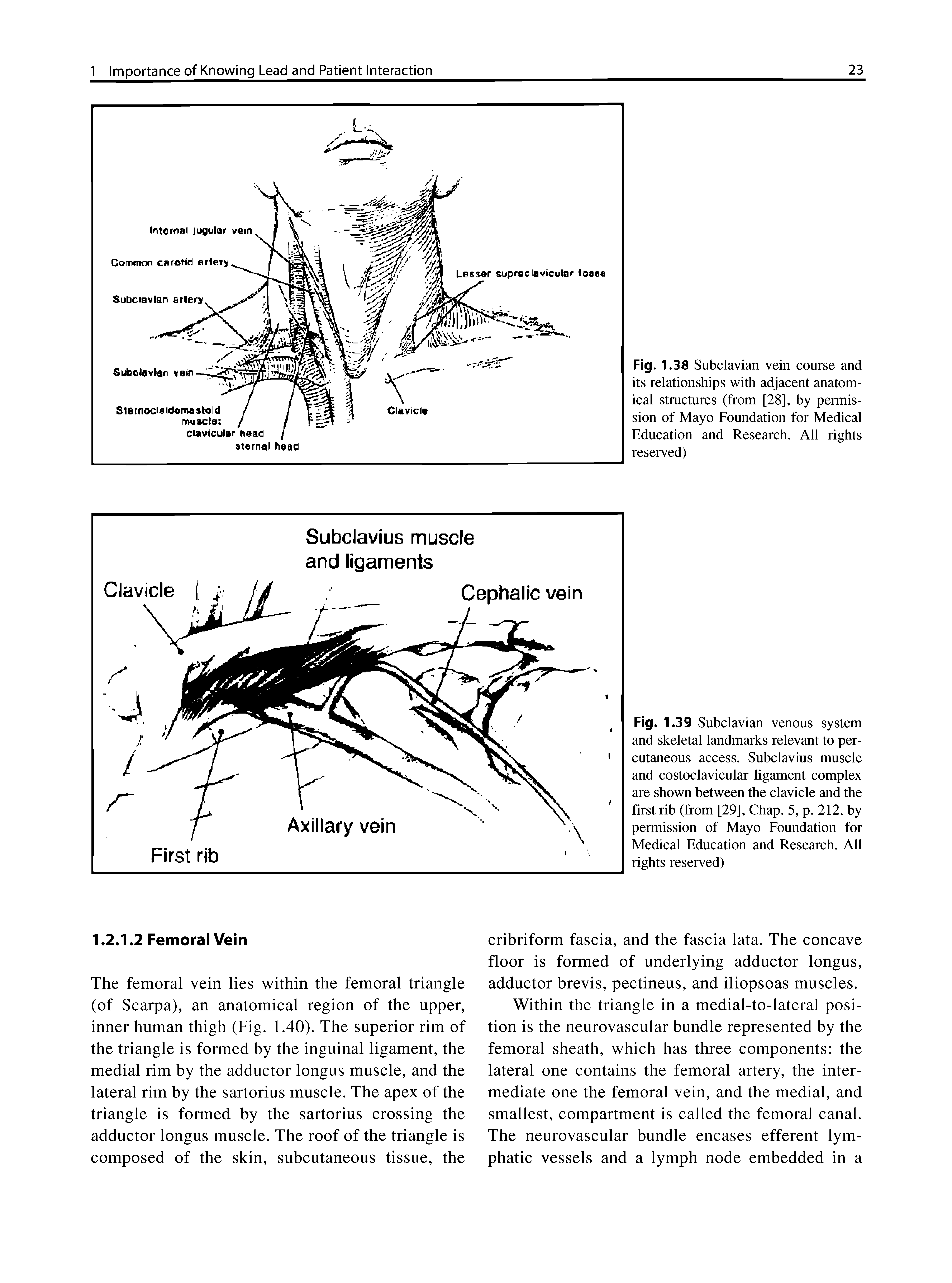 Fig.1. 39 Subclavian venous system and skeletal landmarks relevant to percutaneous access. Subclavius muscle and costoclavicular ligament complex are shown between the clavicle and the first rib (from [29], Chap. 5, p. 212, by permission of Mayo Foundation for Medical Education and Research. All rights reserved)...