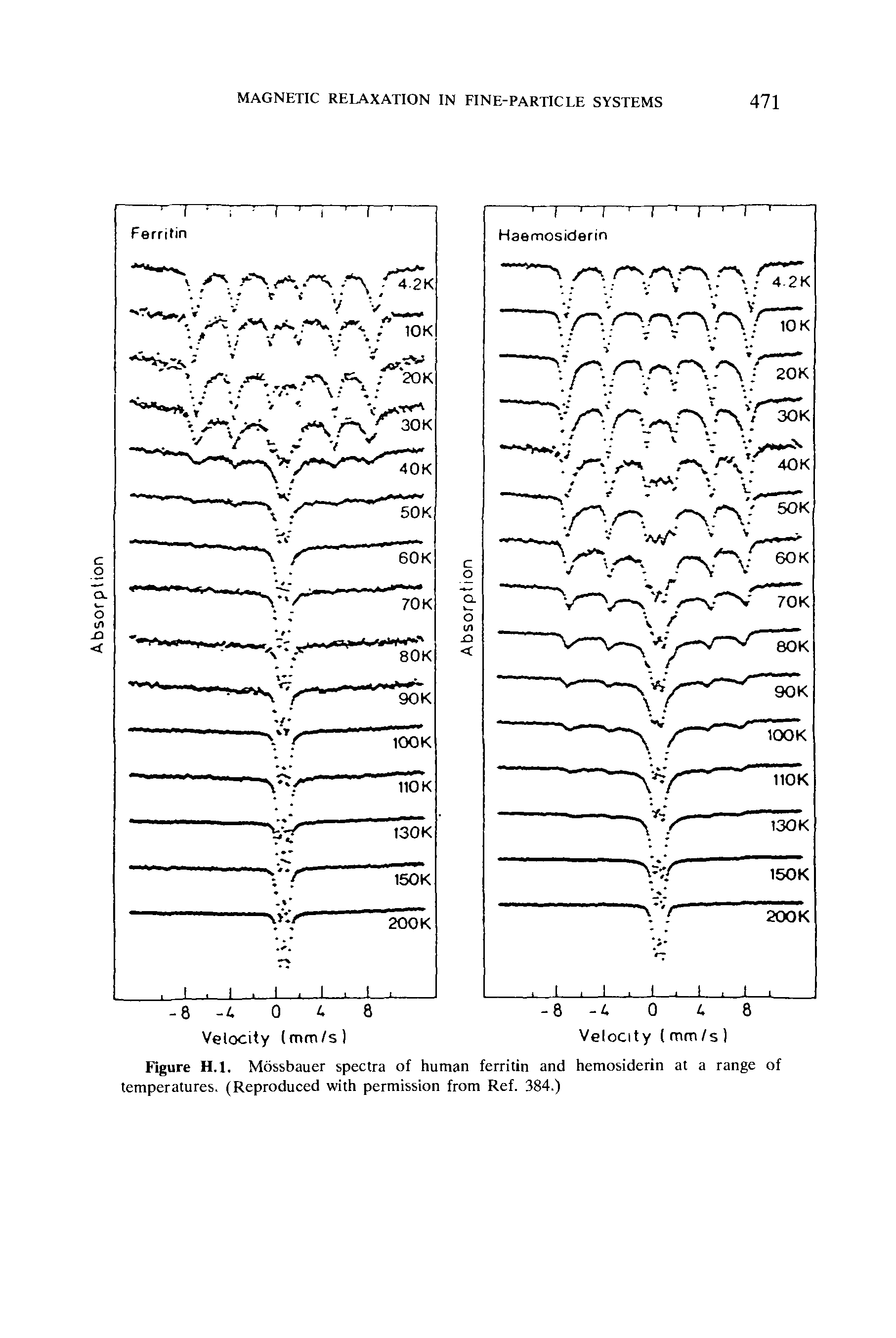 Figure H.l. Mossbauer spectra of human ferritin and hemosiderin at a range of temperatures. (Reproduced with permission from Ref. 384.)...