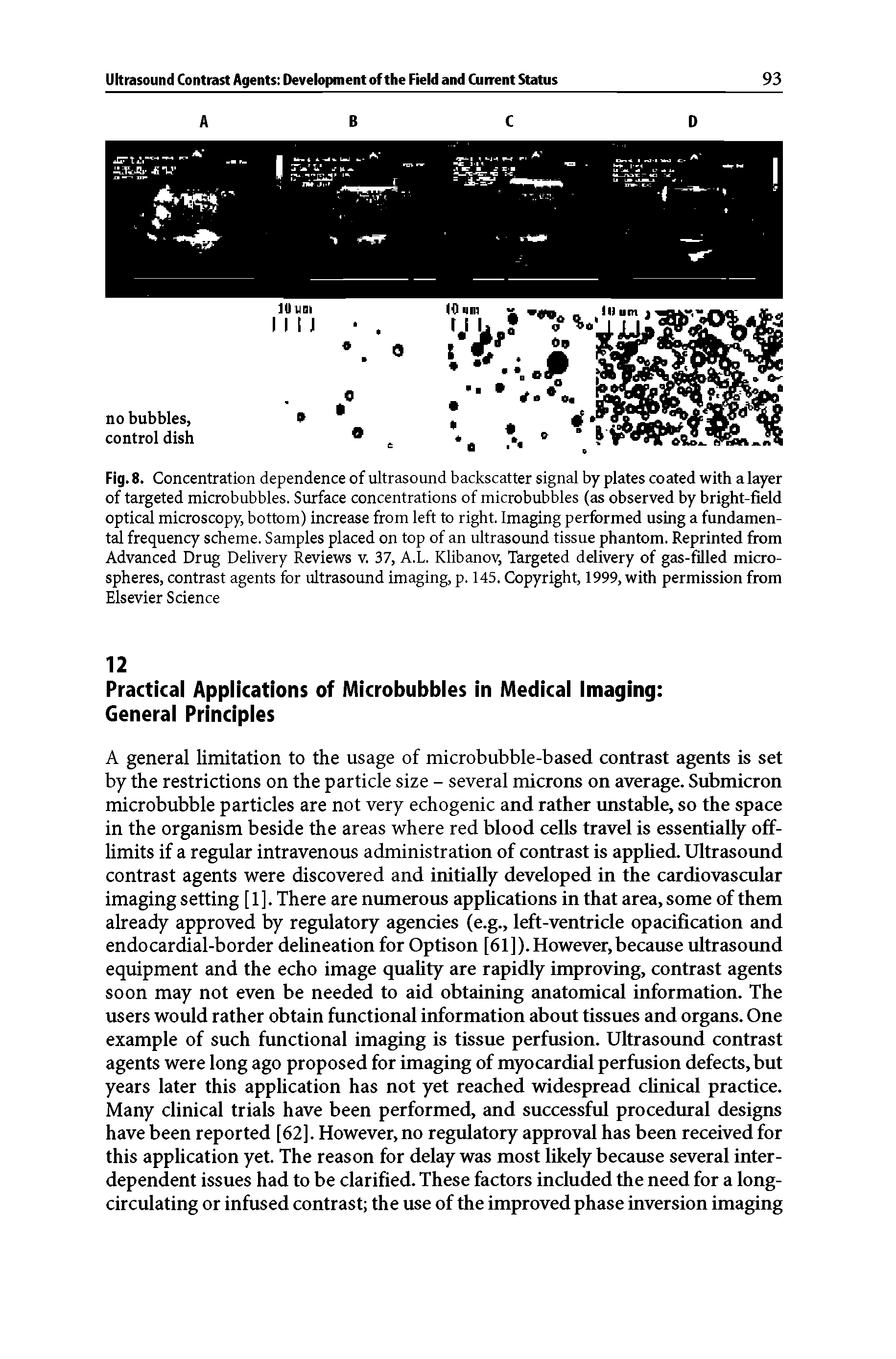 Fig. 8. Concentration dependence of ultrasound backscatter signal by plates coated with a layer of targeted microbubbles. Surface concentrations of microbubbles (as observed by bright-field optical microscopy, bottom) increase from left to right. Imaging performed using a fundamental frequency scheme. Samples placed on top of an ultrasound tissue phantom. Reprinted from Advanced Drug Delivery Reviews v. 37, A.L. Klibanov, Targeted delivery of gas-filled microspheres, contrast agents for ultrasound imaging, p. 145. Copyright, 1999, with permission from Elsevier Science...