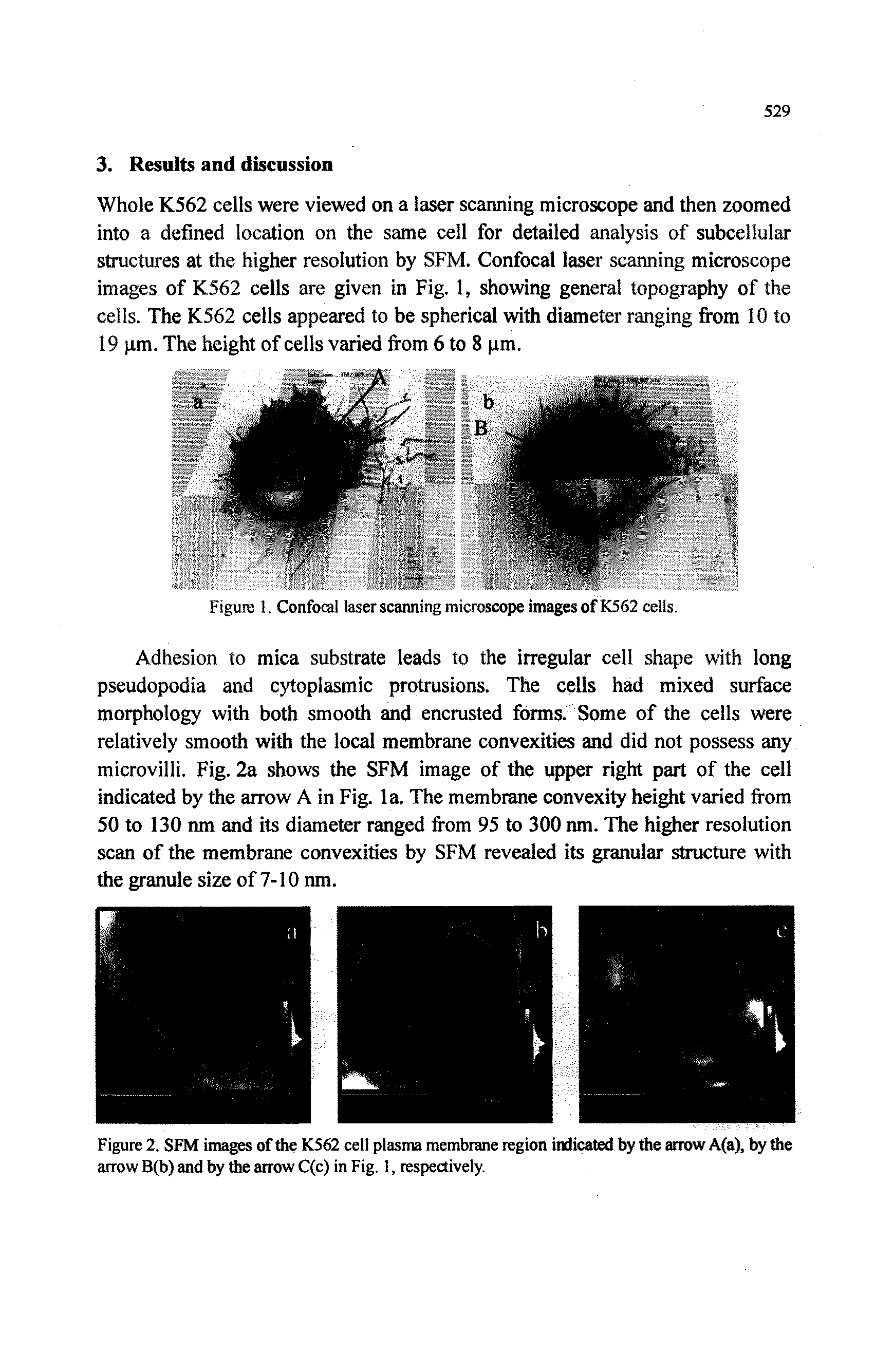 Figure 1. Confocal laser scanning microscope images of K562 cells.