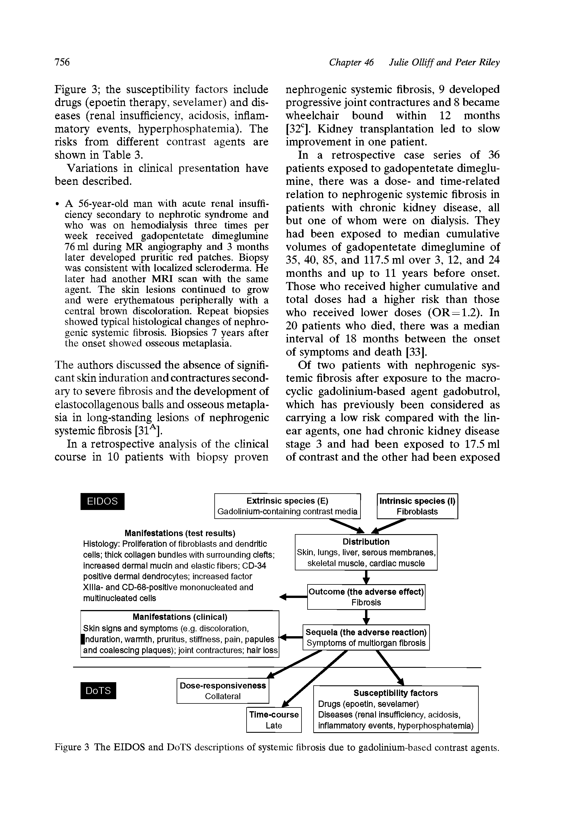 Figure 3 The EIDOS and DoTS descriptions of systemic fibrosis due to gadolinium-based contrast agents.