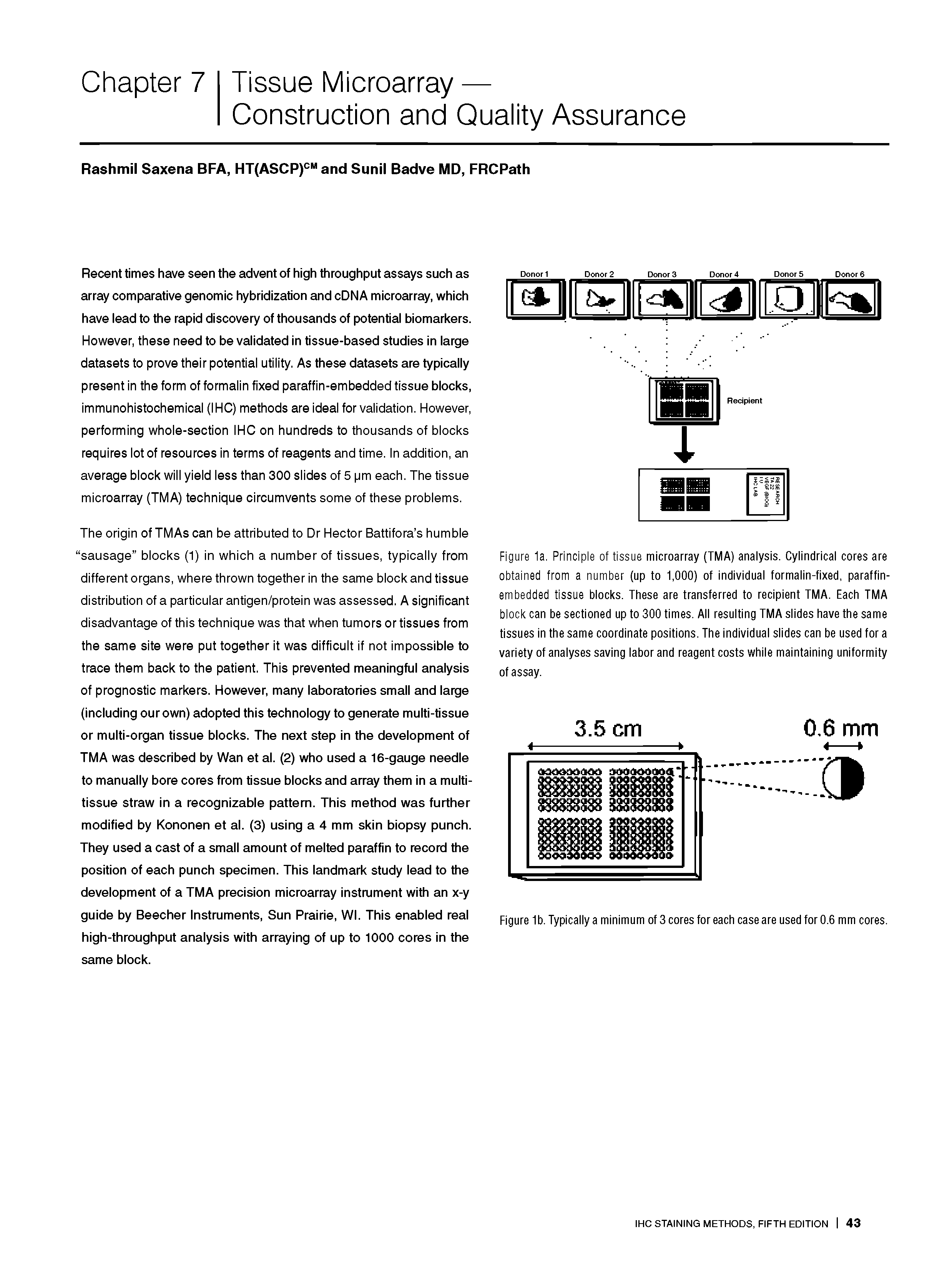 Figure 1a. Principle of tissue microarray (TMA) analysis. Cylindrical cores are obtained from a number (up to 1,000) of individual formalin-fixed, paraffin-embedded tissue blocks. These are transferred to recipient TMA. Each TMA block can be sectioned up to 300 times. All resulting TMA slides have the same tissues in the same coordinate positions. The individual slides can be used for a variety of analyses saving labor and reagent costs while maintaining uniformity of assay.