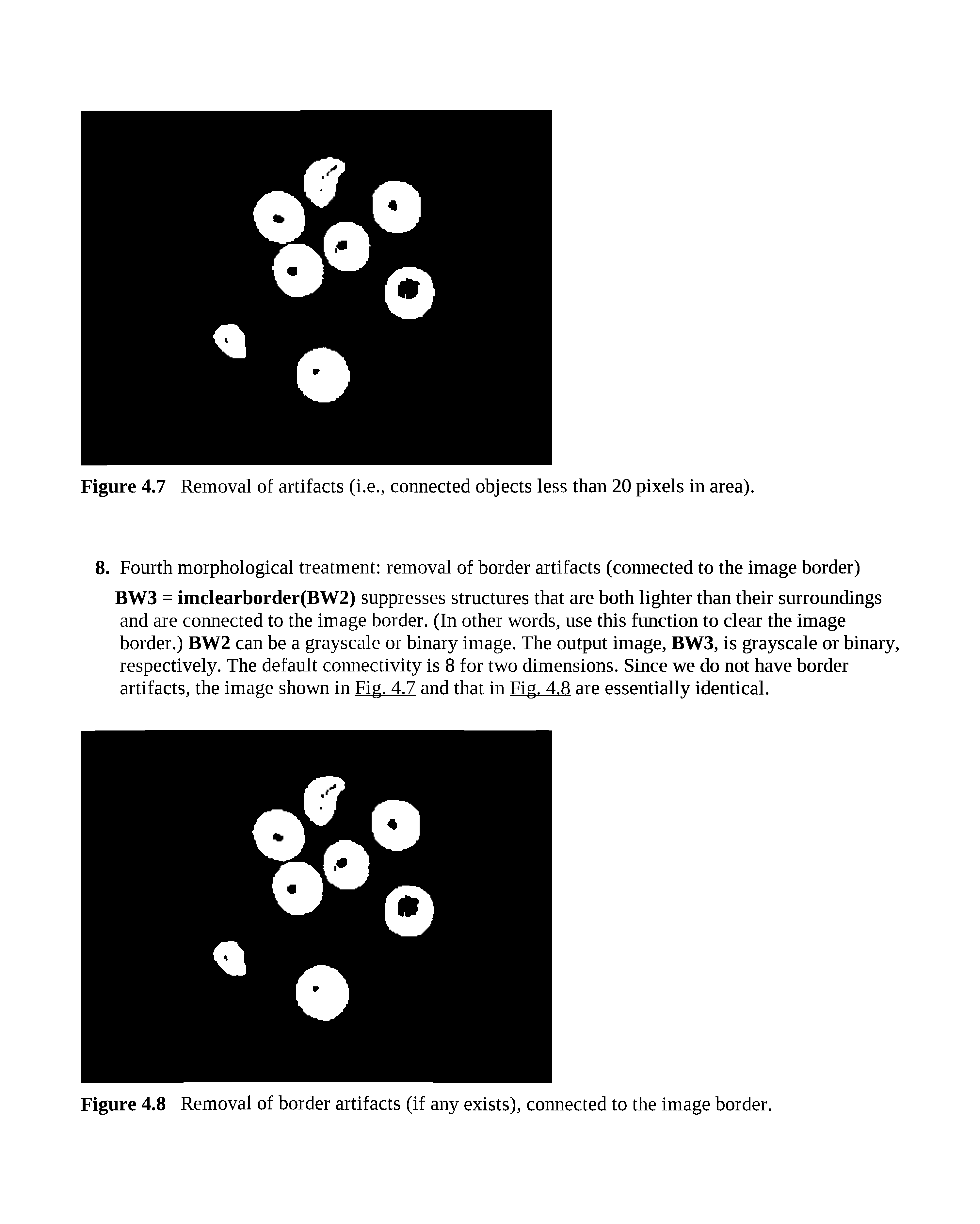 Figure 4.7 Removal of artifacts (i.e., connected objects less than 20 pixels in area).