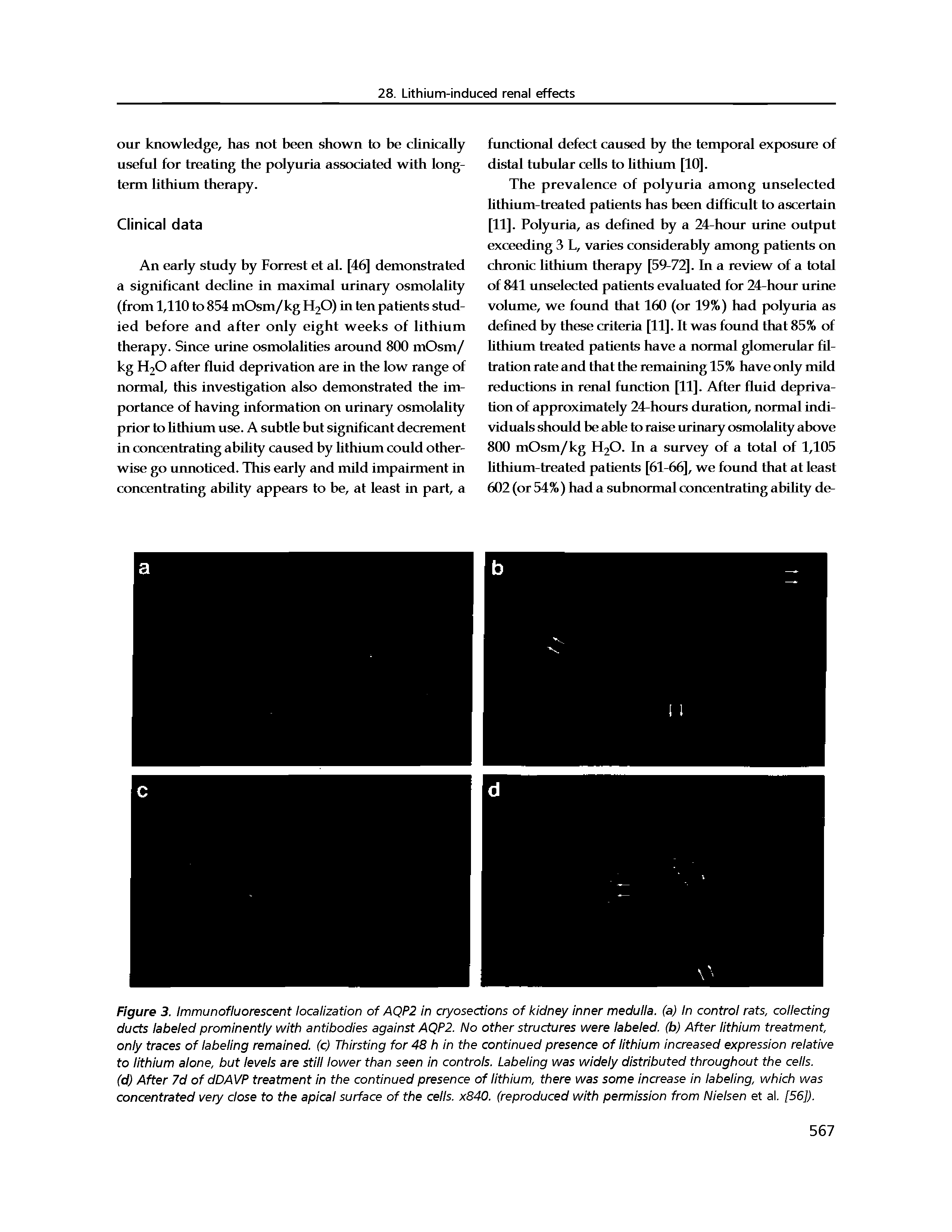 Figure 3. Immunofluorescent localization of AQP2 in cryosections of kidney inner medulla, (a) In control rats, collecting ducts labeled prominently with antibodies against AQP2. No other structures were labeled, (b) After lithium treatment, only traces of labeling remained, (c) Thirsting for 48 h in the continued presence of lithium increased expression relative to lithium alone, but levels are still lower than seen in controls. Labeling was widely distributed throughout the cells.