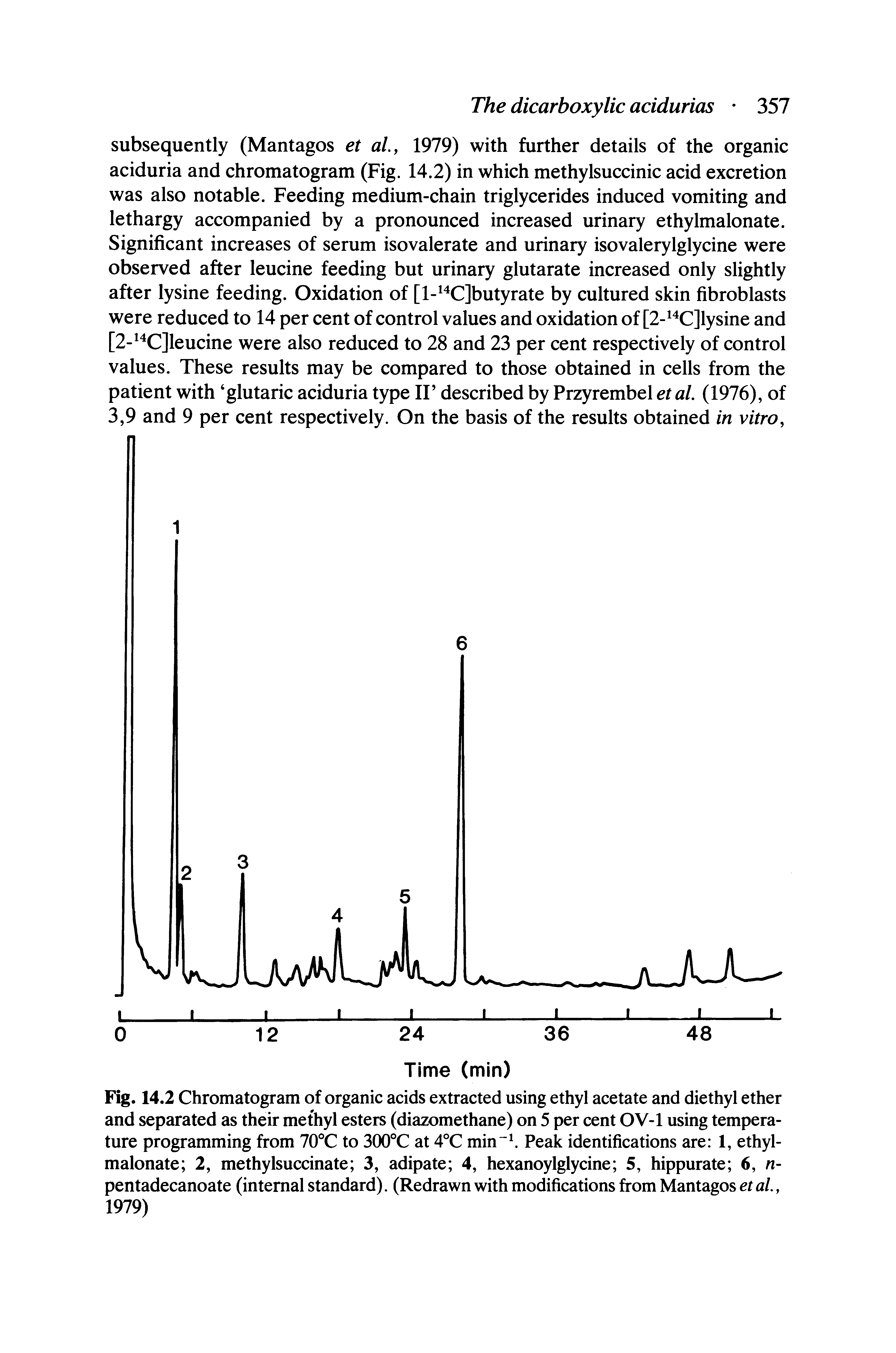 Fig. 14.2 Chromatogram of organic acids extracted using ethyl acetate and diethyl ether and separated as their methyl esters (diazomethane) on 5 per cent OV-1 using temperature programming from 70°C to 300°C at 4°C min Peak identifications are 1, ethylmalonate 2, methylsuccinate 3, adipate 4, hexanoylglycine 5, hippurate 6, n-pentadecanoate (internal standard). (Redrawn with modifications from Mantagos et al., 1979)...